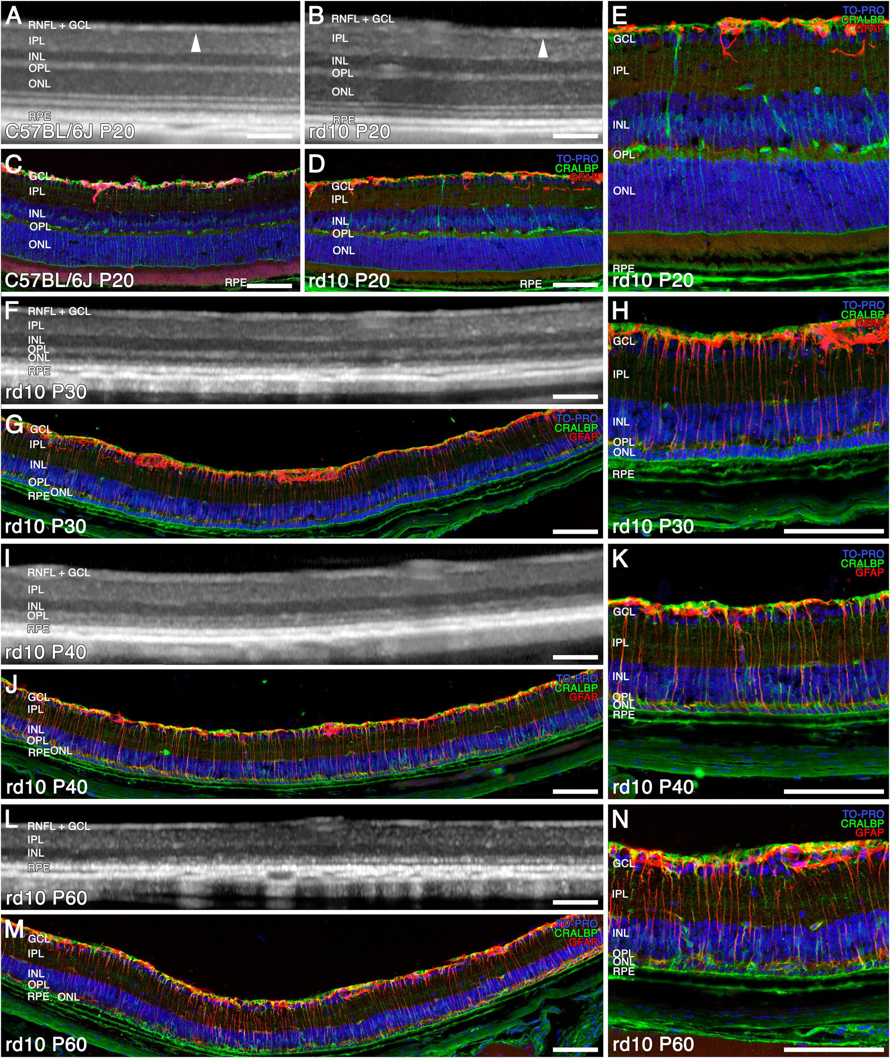 Fluorescent microscopy images and OCT images of retinal sections from mice at different developmental stages and conditions, showing various retinal layers labeled with specific markers. Panels A and C depict C57BL/6J mice at postnatal day 20, while panels B and D show rd10 mice at the same age. Panels E, G, H, J, K, M, and N illustrate the progression of retinal degeneration in rd10 mice at postnatal days 20, 30, 40, and 60, with labeled layers including ganglion cell layer (GCL), inner plexiform layer (IPL), inner nuclear layer (INL), outer plexiform layer (OPL), outer nuclear layer (ONL), and retinal pigment epithelium (RPE).
