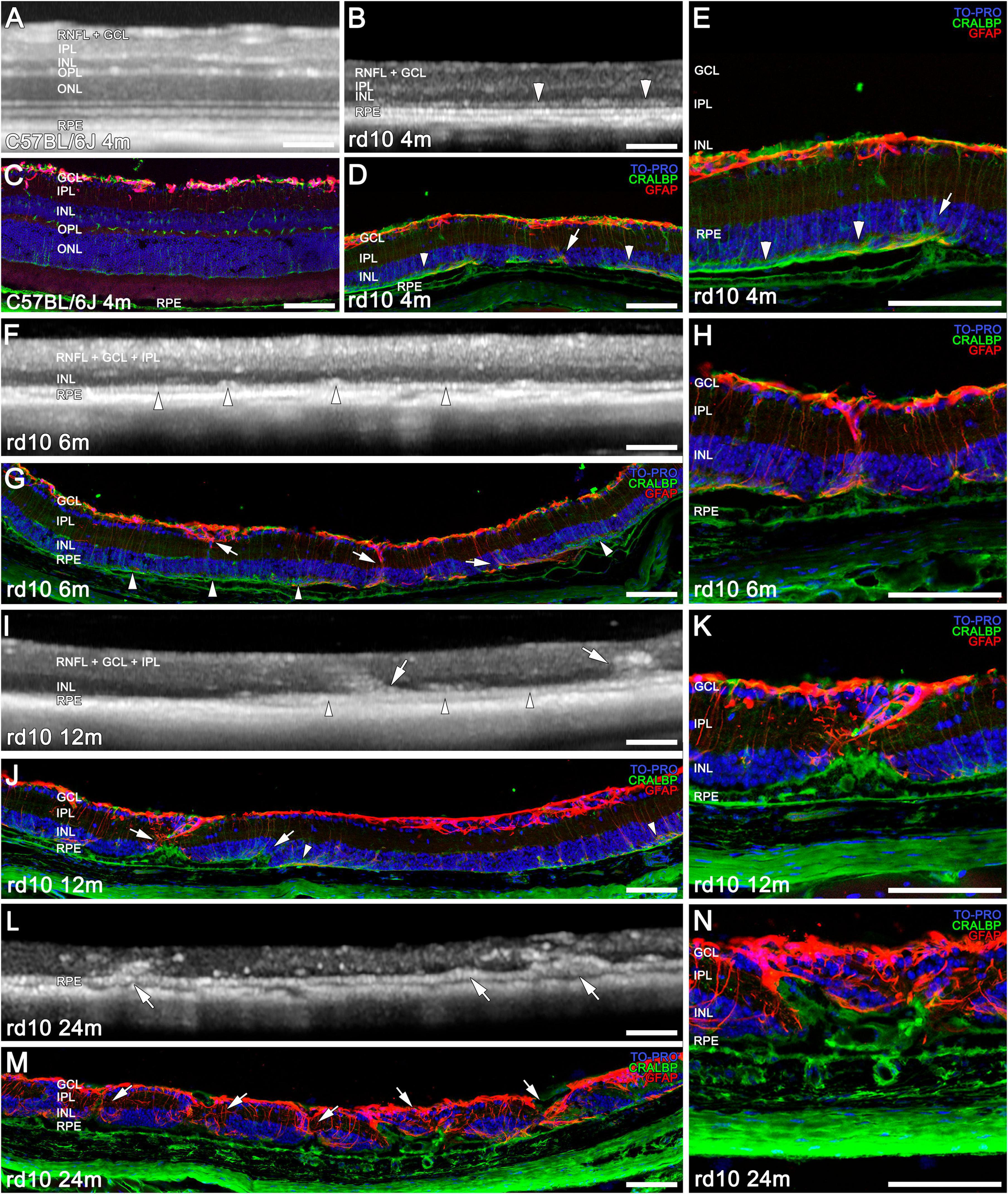 Microscopic images and OCT images showing retinal layers of mice at various ages and strains. Panels A and C show C57BL/6J at 4 months, while panels B, D, E, F, G, H, I, J, K, L, M, and N display rd10 at different ages from 4 months to 24 months. Arrows and arrowheads indicate specific retinal layer details and changes over time. Fluorescent markers highlight different structures, with colors representing specific proteins. Scale bars are present in each image.