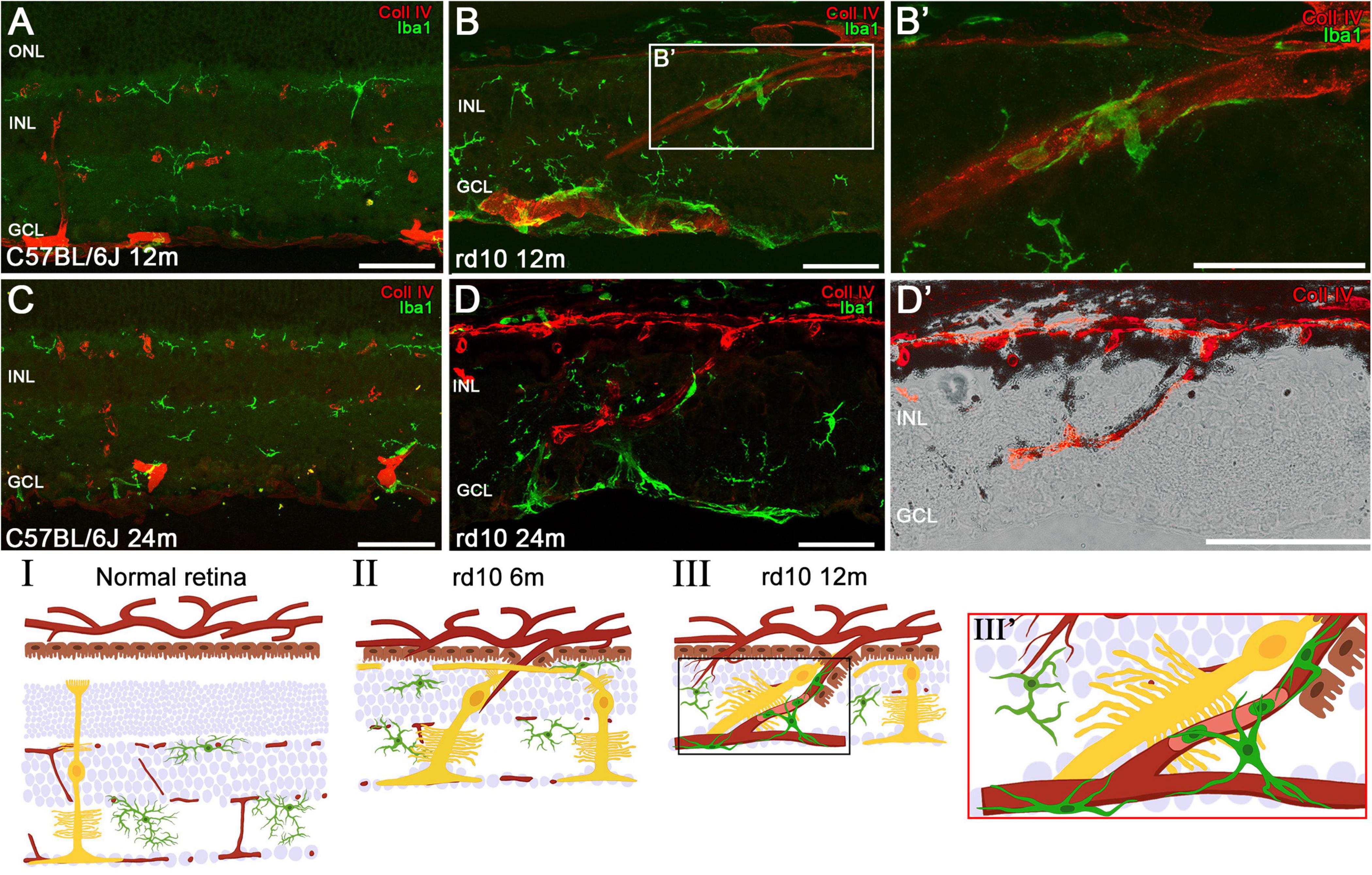 Sections A to D’ show retina images from C57BL/6J and rd10 mice, highlighting collagen IV in red and Iba1 in green, depicting different ages and magnifications. Panels I to III illustrate the structure of normal and diseased retinas at different ages, with a focus on changes in retinal layers and cell morphology.