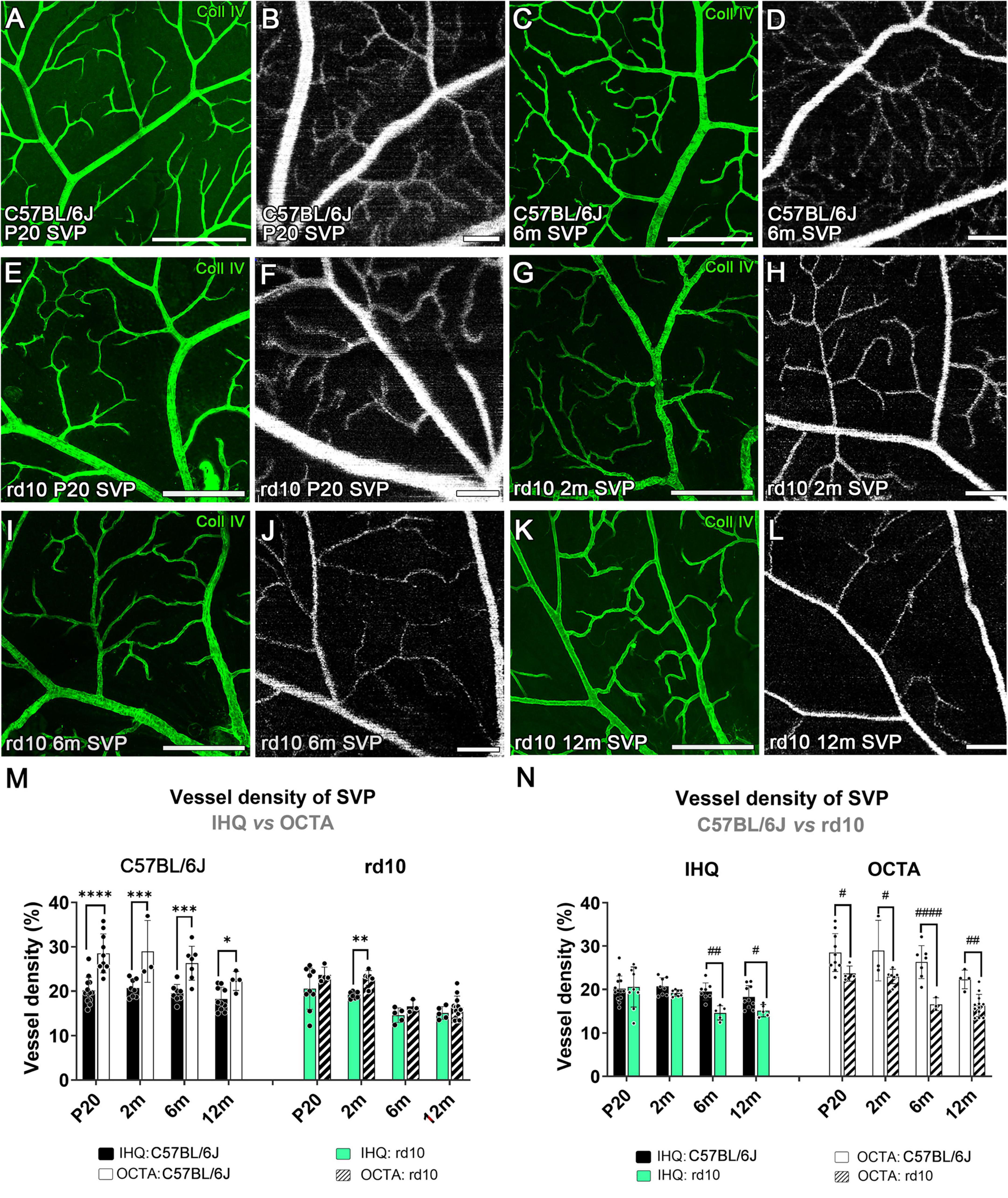 Fluorescent and OCTA images show retinal vessel structures in the SVP (superficial vascular plexus) of C57BL/6J and rd10 mice, with panels labeled A to L, indicating different ages. Graphs M and N depict vessel density comparisons using IHQ and OCTA methods, with significant differences marked by symbols.