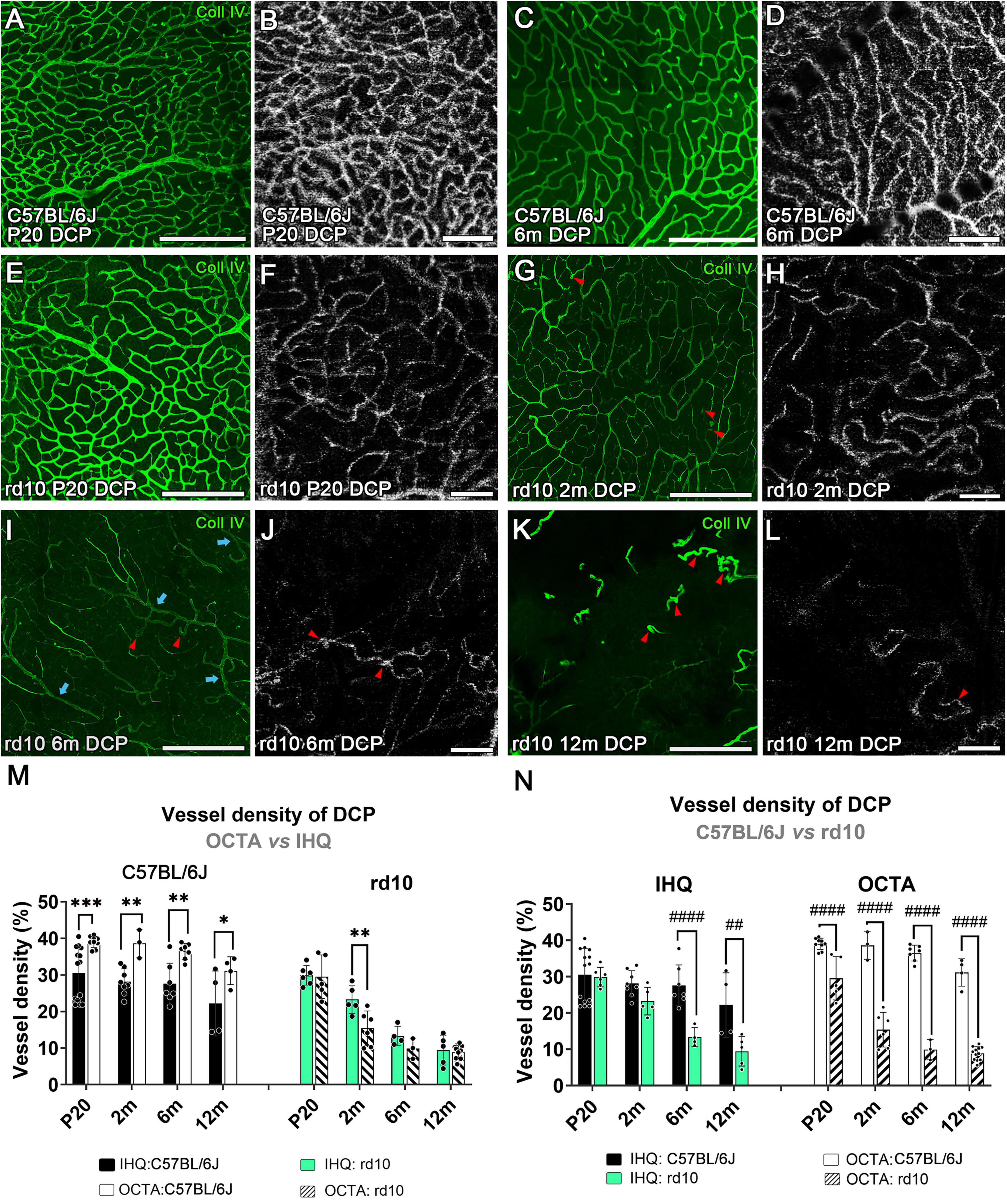 Fluorescent and OCTA images showing vessel density in the DCP (deepcapillary plexus retinal) of C57BL/6J and rd10 mice at various ages (P20, 2m, 6m, 12m) with collagen IV staining. Panels A-D show C57BL/6J images, while E-L depict rd10. Graphs M and N illustrate vessel density comparisons using IHQ and OCTA methods for both mouse types across different time points.