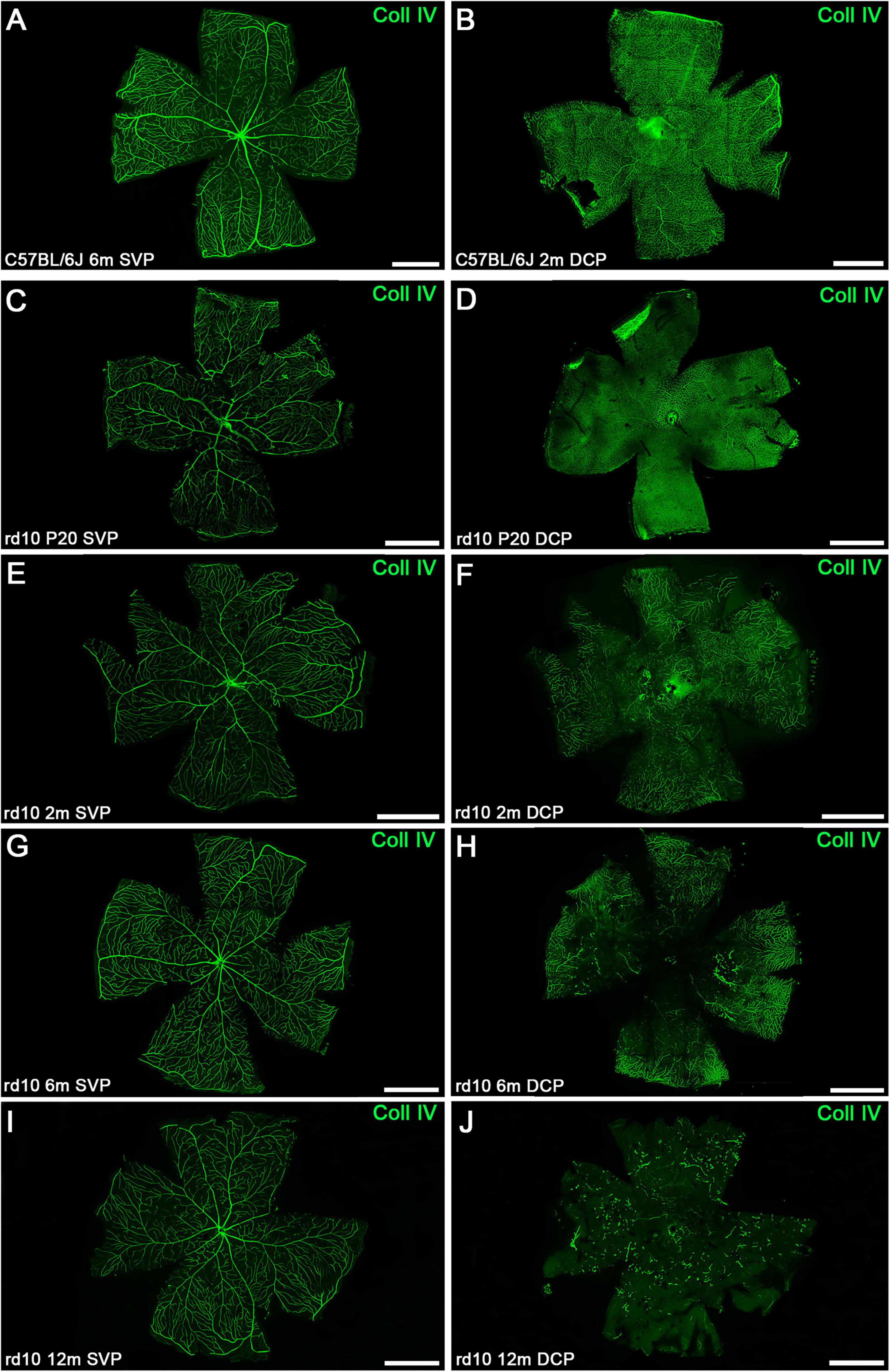 Fluorescent microscopy images showing retinal structures stained with collagen IV in green. Panels A-J display various mouse models and time points. Each image shows distinct vascular patterns: A C, E, G and I show the superficial vascular plexus (SVP), whereas panels B, D, F, H and J correspond to the deep capillary plexus (DCP). Panels A and B depict C57BL/6J mice, while the remaining panels show rd10 mice at different ages. The images are labeled with mouse model identifiers and age indicators.