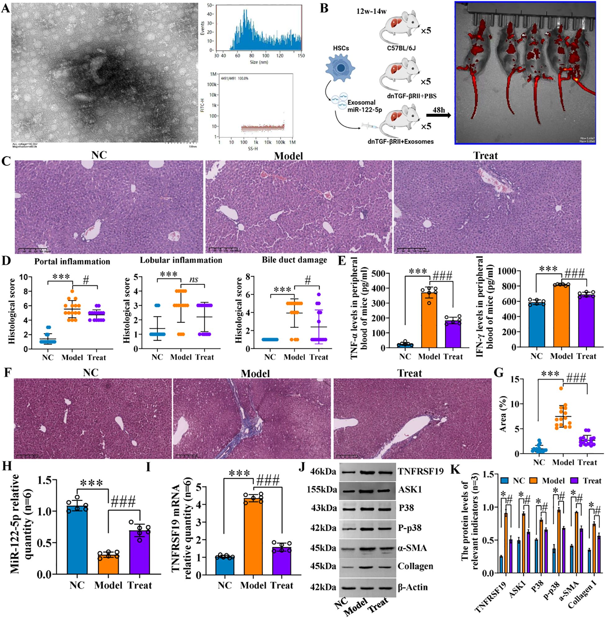 The image is a scientific figure comprised of multiple panels detailing an experiment. Panel A shows an electron micrograph and graphs related to particle analysis. Panel B is a schematic of an experimental setup involving mice. Panel C displays histological images comparing NC (normal control), Model, and Treat groups. Panel D presents bar graphs of histological scores for inflammation and damage. Panel E features bar graphs for TNF-alpha and IFN-gamma levels. Panel F contains additional histology images. Panels G to K show various bar graphs and a Western blot analysis related to gene and protein expression levels in different groups.