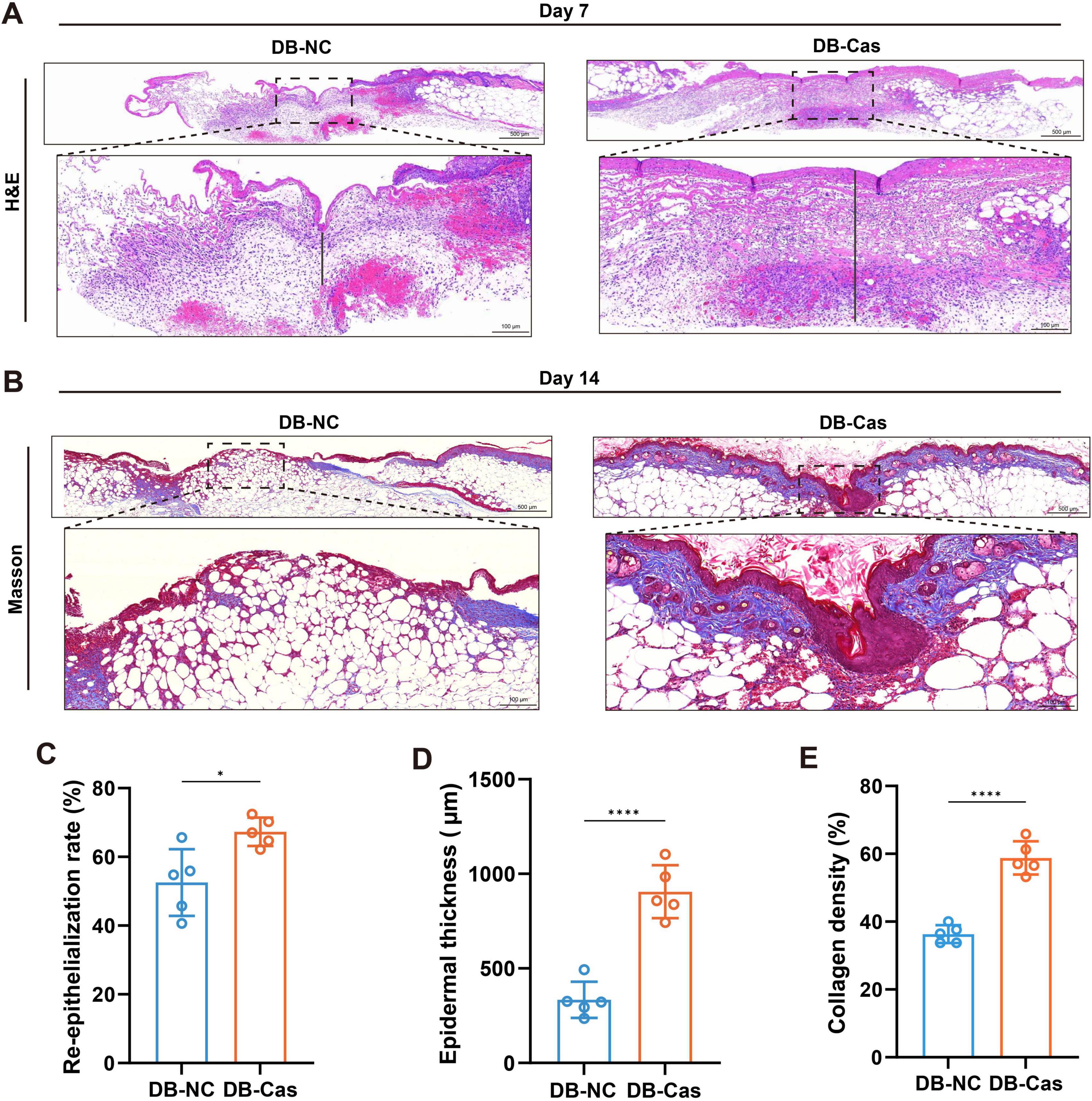 Histological images and charts comparing DB-NC and DB-Cas groups. Panels A and B display hematoxylin and eosin (H&E) and Masson’s trichrome staining at days seven and fourteen, respectively, showing skin tissue morphology. Charts C, D, and E present quantitative data on re-epithelialization rate, epidermal thickness, and collagen density, respectively, indicating better outcomes for the DB-Cas group.
