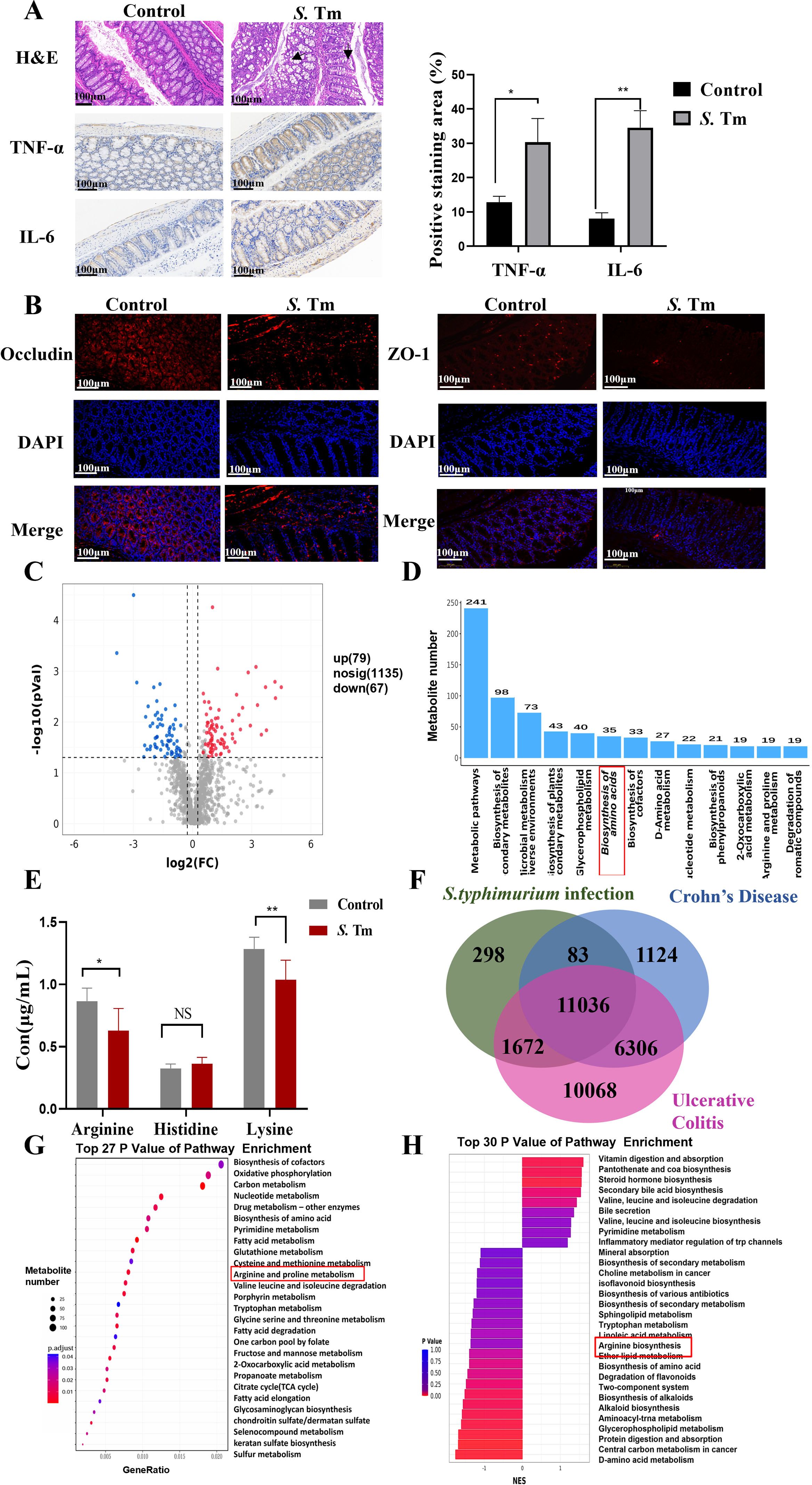 Scientific figure with labeled sections A to H. A: Microscopic images comparing intestinal samples under control and S. Tm conditions, showing H&E staining and TNF-α, IL-6 expression with a bar graph of positive staining area percentages. B: Immunofluorescence images of Occludin and ZO-1 proteins with DAPI staining in control and S. Tm conditions. C: Volcano plot illustrating gene expression changes with marked upregulated, downregulated, and non-significant points. D: Bar graph of enriched pathways with various counts. E: Bar graph comparing concentrations of Arginine, Histidine, and Lysine between control and S. Tm conditions. F: Venn diagram comparing gene involvement in S. typhimurium infection, Crohn's Disease, and Ulcerative Colitis. G: Dot plot of pathway analyses with p-values and counts for various metabolic processes. H: Bar graph showing the top thirty pathways enriched in GSEA with a color scale for p-values. Each section visually presents data differences between control and S. Tm groups.