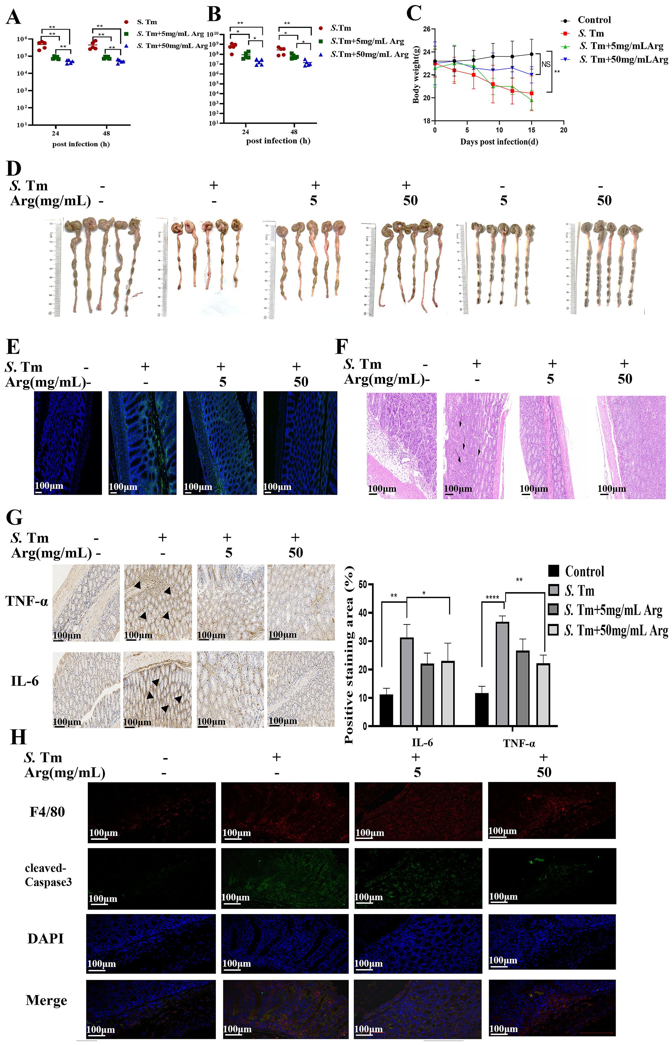 Graphs and images depict the effects of different concentrations of arginine on S. Tm infection. Panels A and B show the bacterial count over time with statistical significance marked. Panel C presents body weight changes over time with control and treatment groups. Panel D displays images of intestines under various treatments. Panels E and F show histological images of tissue samples. Panel G provides immunohistochemistry results for TNF-α and IL-6, accompanied by a bar graph comparing positive staining areas. Panel H displays fluorescence microscopy images with various antibody stainings. Overall, treatment impacts inflammation and tissue structure.