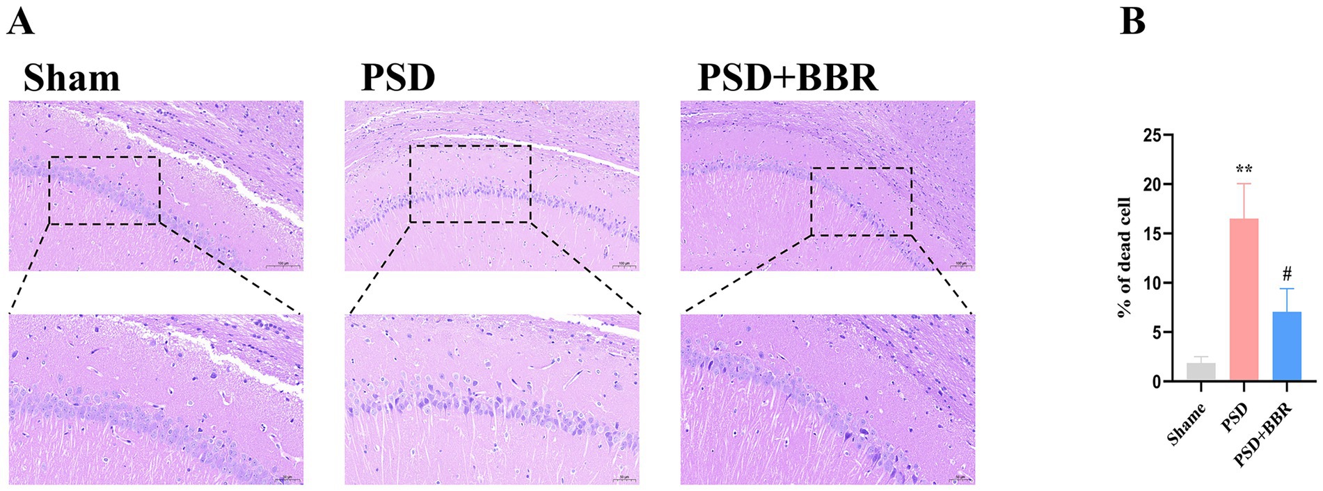 Panel A shows histological images of brain sections under three conditions: Sham, PSD, and PSD plus BBR, with highlighted areas magnified. Panel B presents a bar chart showing the percentage of dead cells in each condition, with PSD having the highest percentage, followed by PSD plus BBR, and Sham having the lowest.