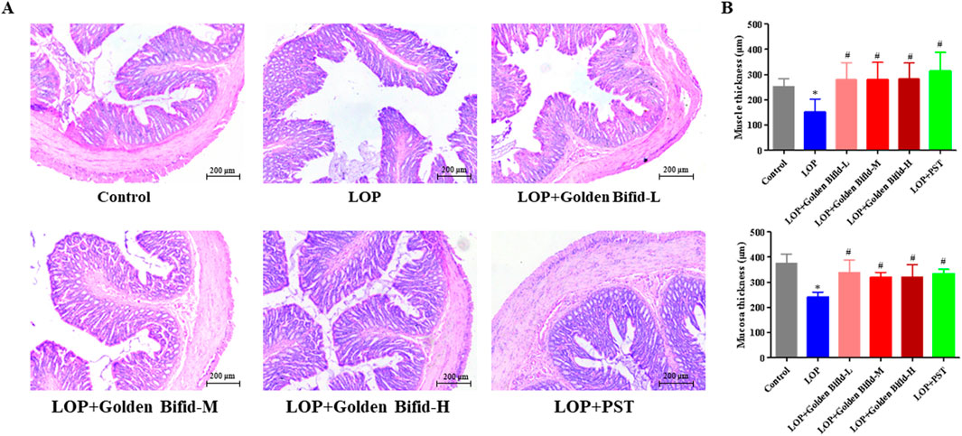 Panel A shows histological images of intestinal tissues under different conditions: Control, LOP, LOP with varying doses of Golden Bifid, and LOP with PST. Panel B presents bar charts of muscle and mucosa thickness under these conditions, indicating variations in tissue measurements across treatments, with significant differences marked.