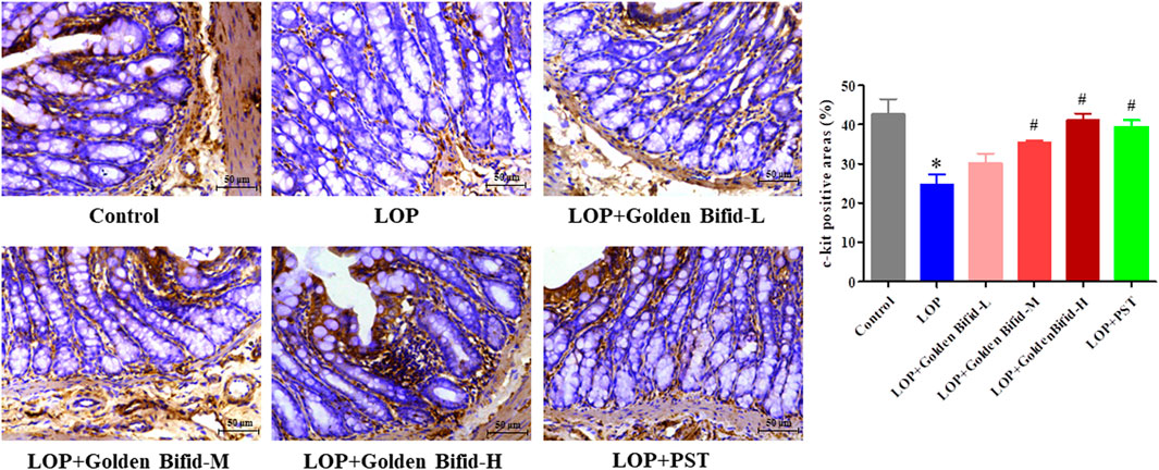 Histological images and a bar graph depicting c-kit positive areas across different groups: Control, LOP, LOP with Golden Bifid at low, medium, high doses, and LOP with PST. Stained tissues show varying intensities. The bar graph indicates percentage of c-kit positive areas, with Control group having the highest percentage and LOP group the lowest. Groups treated with Golden Bifid or PST show increased c-kit positivity compared to LOP alone, suggesting a possible therapeutic effect.