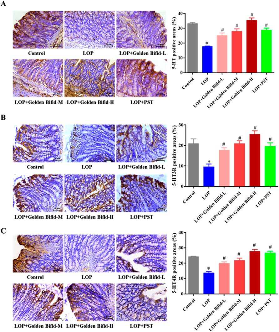 Three panels labeled A, B, and C show microscopic images and corresponding bar graphs. Each panel includes images showing tissue sections stained in various conditions: Control, LOP, LOP+Golden Bifid-L, LOP+Golden Bifid-M, LOP+Golden Bifid-H, and LOP+PST. The bar graphs illustrate the percentage of positive areas for S-H1, S-H1R, and S-H1R, respectively. The graphs indicate statistically significant differences, marked by asterisks and hashtags, among the conditions.