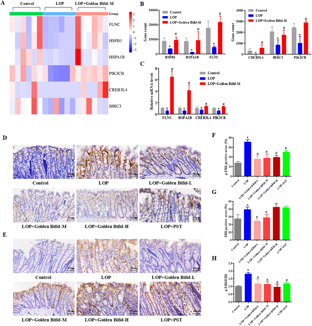 A composite image includes several panels: A) A heatmap showing gene expression levels for FLNC, HSPB1, HSPA1B, PIK3CB, CREB3L4, and BIRC3 across different groups. B) Two bar graphs comparing gene counts for HSPB1, HSPA1B, FLNC, CREB3L4, BIRC3L4, and PIK3CB among Control, LOP, and LOP+Golden Bifid-M groups. C) A bar graph illustrating relative mRNA levels for several genes across the three groups. D and E) Microscopy images of tissue sections stained to show differences across multiple treatment groups. F, G, and H) Bar graphs indicating percentage values of positive areas in various treatment conditions for p-ERK, ERβ, and p-ERK/ERβ, respectively.