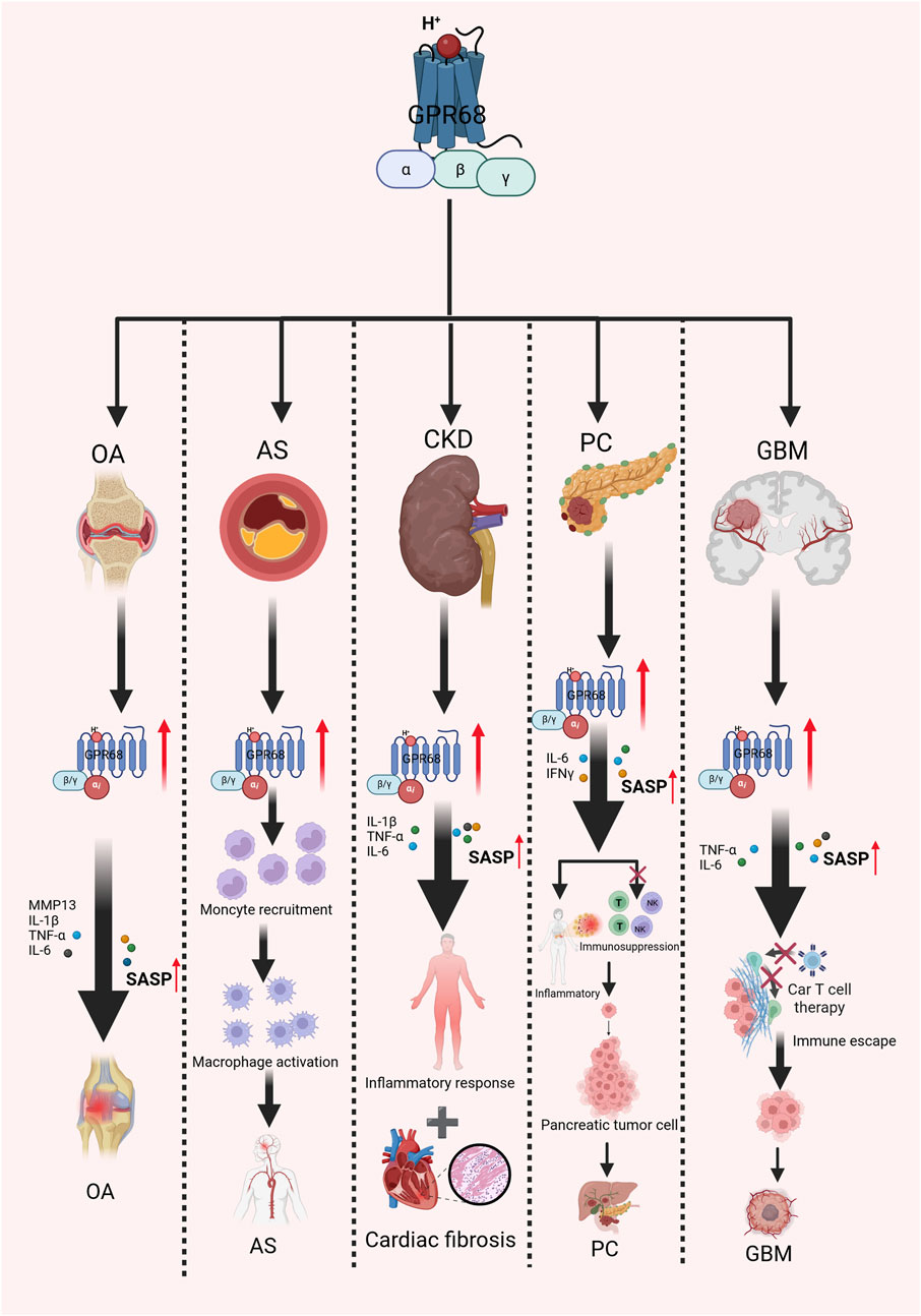 Diagram showing the role of GPR68 in different diseases. GPR68 activation leads to osteoarthritis (OA), atherosclerosis (AS), chronic kidney disease (CKD), pancreatic cancer (PC), and glioblastoma (GBM). The diagram details pathways for each disease, including inflammatory responses, monocyte recruitment, immune suppression, and tumor cell impact. The illustration highlights various biological molecules and processes associated with each condition, such as SASP, TNF-α, IL-6, and others, with arrows indicating the progression and effects on different organs.