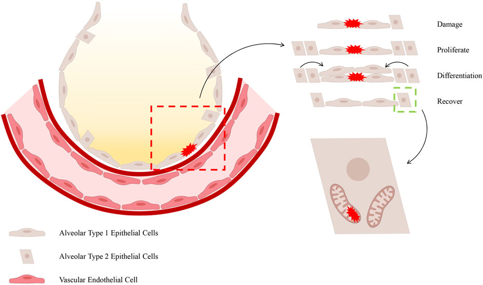 Illustration of lung alveoli recovery process, showing alveolar type 1 and 2 epithelial cells and vascular endothelial cells. Damage occurs and is followed by cell proliferation, differentiation, and recovery. Arrows indicate the sequence, and labeled boxes highlight each stage.