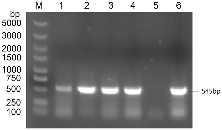 Gel electrophoresis image showing DNA bands. Lane M contains a molecular marker with bands at 5000, 3000, 2000, 1500, 1000, 750, 500, 250, and 100 base pairs. Lanes 1 to 6 show DNA bands at approximately 545 base pairs.
