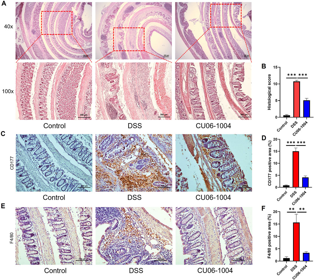 Histological analysis of colon tissue under different conditions, including Control, DSS, and CU06-1004, at 40x and 100x magnification with red dashed boxes indicating zoomed areas. Bar graphs show histological scores and positive areas for CD177 and F4/80 markers, with DSS significantly altered compared to Control and CU06-1004. Immunostaining images for CD177 and F4/80 markers illustrate expression differences in tissue samples.