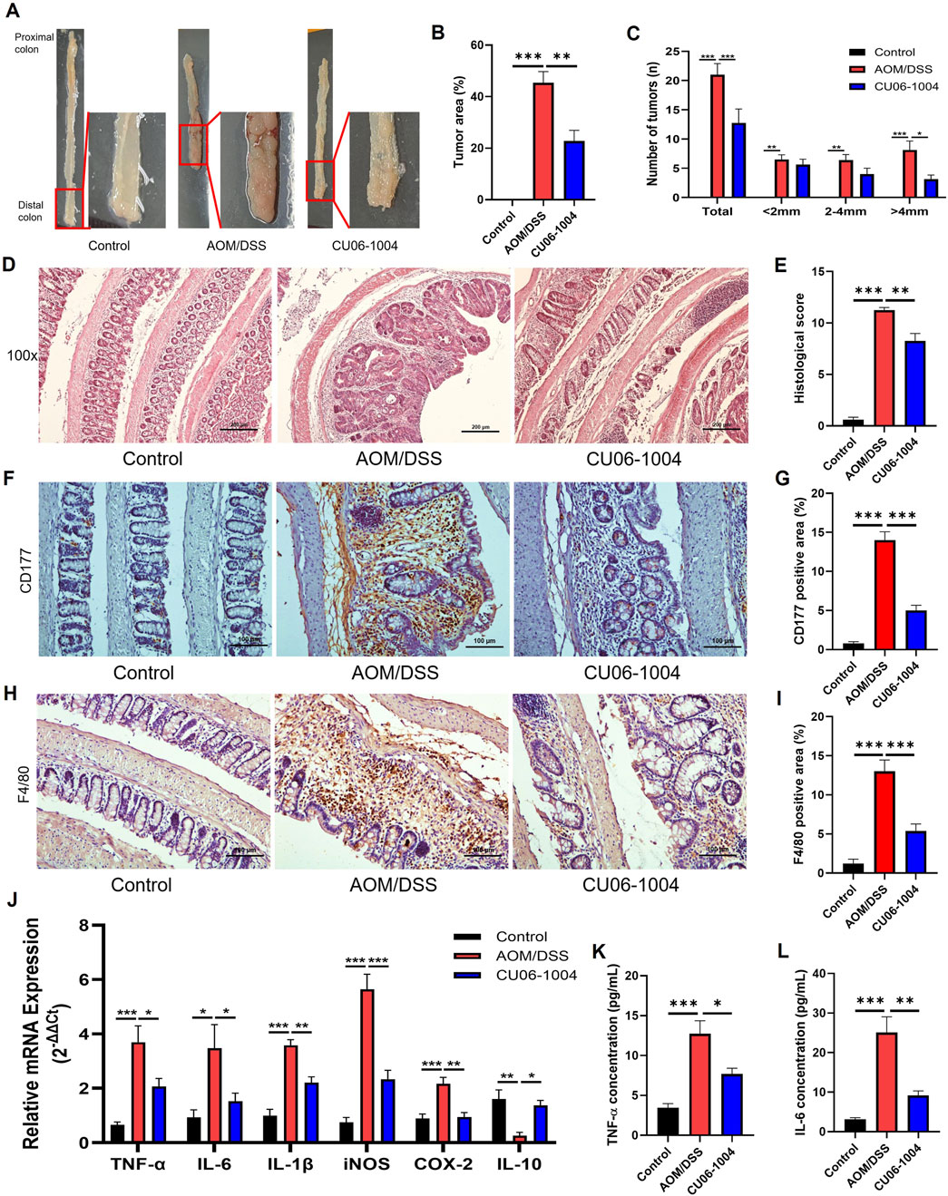 A composite image depicting experimental results. Panel A: Images of colon sections from Control, AOM/DSS, and CU06-1004 groups. Panel B: Bar chart showing tumor area percentages. Panel C: Bar chart of tumor numbers by size. Panel D: Histological sections at 100x magnification. Panel E: Bar chart of histological scores. Panel F: CD177 staining in colon tissues. Panel G: Bar chart of CD177 positive areas. Panel H: F4/80 staining in colon tissues. Panel I: Bar chart of F4/80 positive areas. Panel J: Bar chart of mRNA expression levels for TNF-α, IL-6, IL-1β, iNOS, COX-2, IL-10. Panels K and L: Bar charts of TNF-α and IL-6 concentrations. Statistical significance is indicated by asterisks.