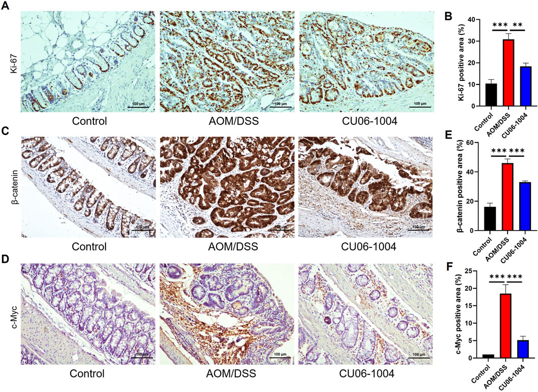 Panel A shows Ki-67 staining in control, AOM/DSS, and CU06-1004 treated samples. Panel B is a bar graph comparing Ki-67 positive areas. Panel C displays β-catenin staining with corresponding graph in Panel E. Panel D shows c-Myc staining, with a bar graph in Panel F for c-Myc positive areas. Each panel compares control, AOM/DSS, and CU06-1004 groups. Scale bars indicate 100 micrometers.