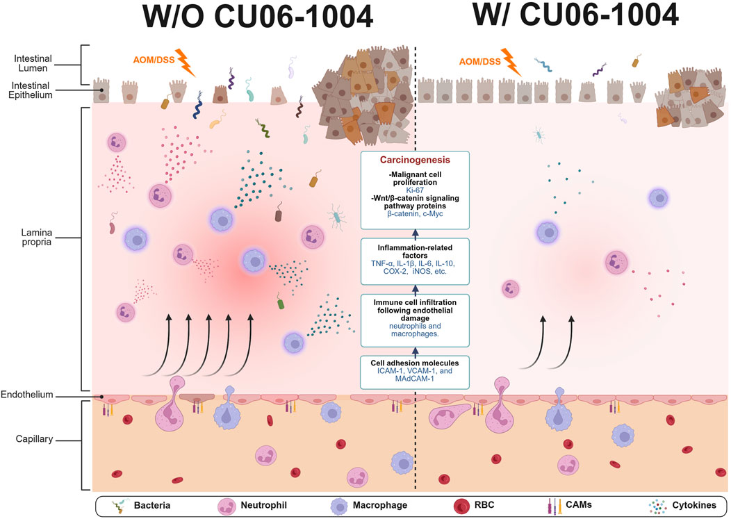 Diagram comparing intestinal changes without and with CU06-1004. On the left, absence of CU06-1004 shows damaged epithelium, increased immune cell infiltration, and carcinogenesis indicators like Ki-67. Inflammation-related factors and cell adhesion molecules are present. On the right, with CU06-1004, the epithelium is less damaged, with reduced immune cell infiltration and fewer inflammatory factors. Elements are labeled, including bacteria, neutrophils, macrophages, red blood cells, cell adhesion molecules, and cytokines.