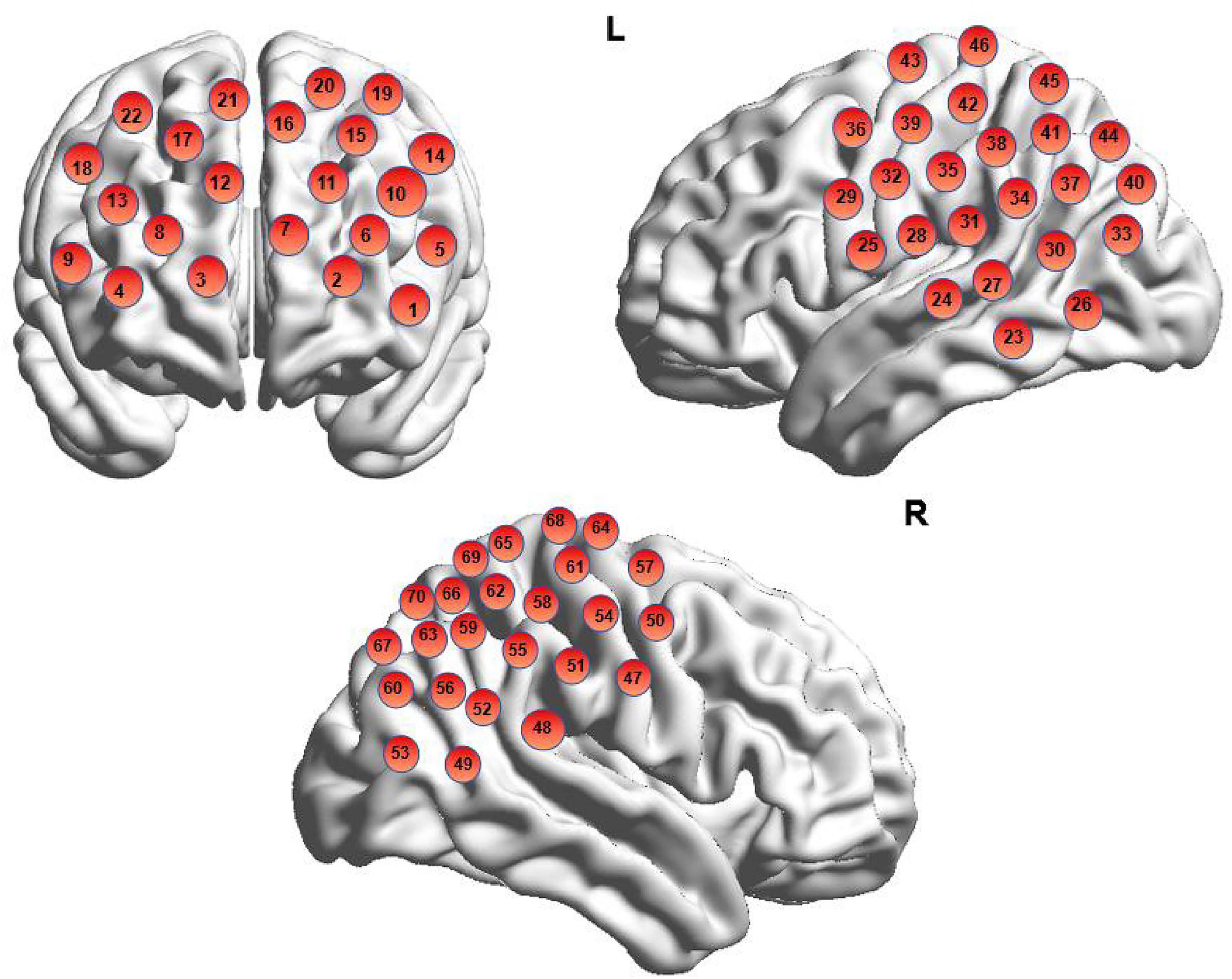 Diagram showing three brain views labeled with numbered red circles. The top left displays the brain’s frontal view with numbers 1 to 24. The top right shows the left hemisphere with numbers 25 to 46. The bottom image illustrates the right hemisphere with numbers 47 to 69. Each circle potentially represents specific brain regions.