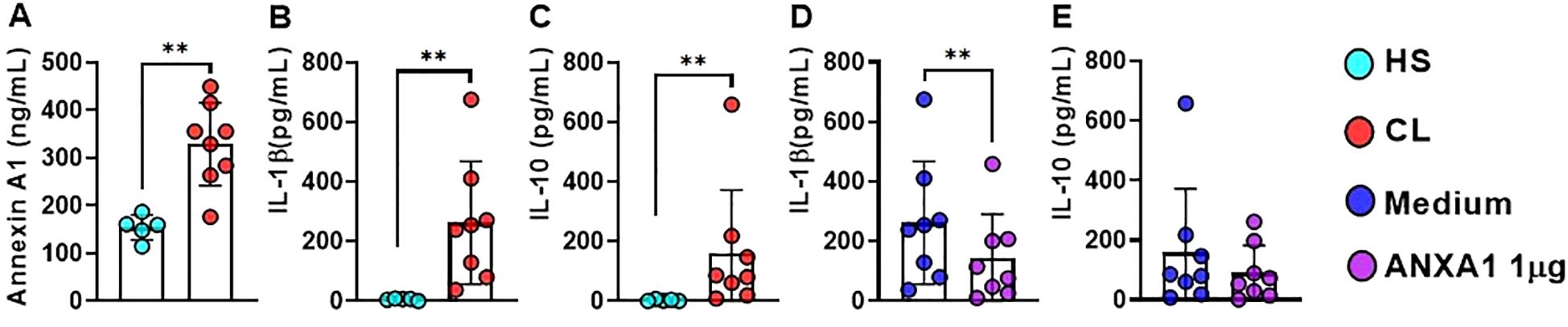Bar graphs labeled A to E present data on Annexin A1 and interleukins IL-1β and IL-10 levels in different conditions. Panel A shows higher Annexin A1 in CL compared to HS. Panels B and C display increased IL-1β and IL-10 in CL compared to HS. Panels D and E show IL-1β and IL-10 levels, with ANXA1 1μg significantly affecting IL-1β compared to Medium. Color codes: cyan for HS, red for CL, blue for Medium, purple for ANXA1 1μg. Error bars indicate variability, and asterisks denote statistical significance.