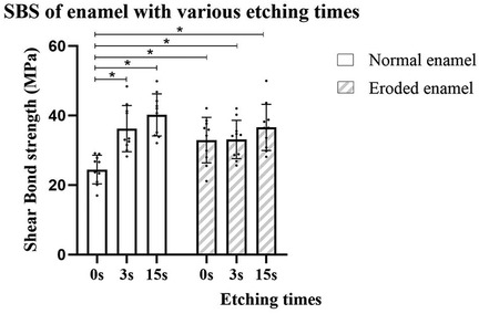 Bar chart illustrating shear bond strength of normal and eroded enamel at etching times of zero, three, and fifteen seconds. Normal enamel bars are unpatterned; eroded enamel bars are striped. Shear bond strength is measured in megapascals. Normal enamel shows increased bond strength with longer etching times, while eroded enamel shows less variation. Statistical significance is indicated with asterisks.
