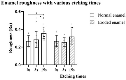 Bar graph showing enamel roughness (Ra) against etching times (0, 3, 15 seconds) for normal and eroded enamel. Normal enamel bars indicate higher roughness than eroded enamel at 0 and 3 seconds, while both show similar roughness at 15 seconds. Significance is noted with asterisks above certain bars.