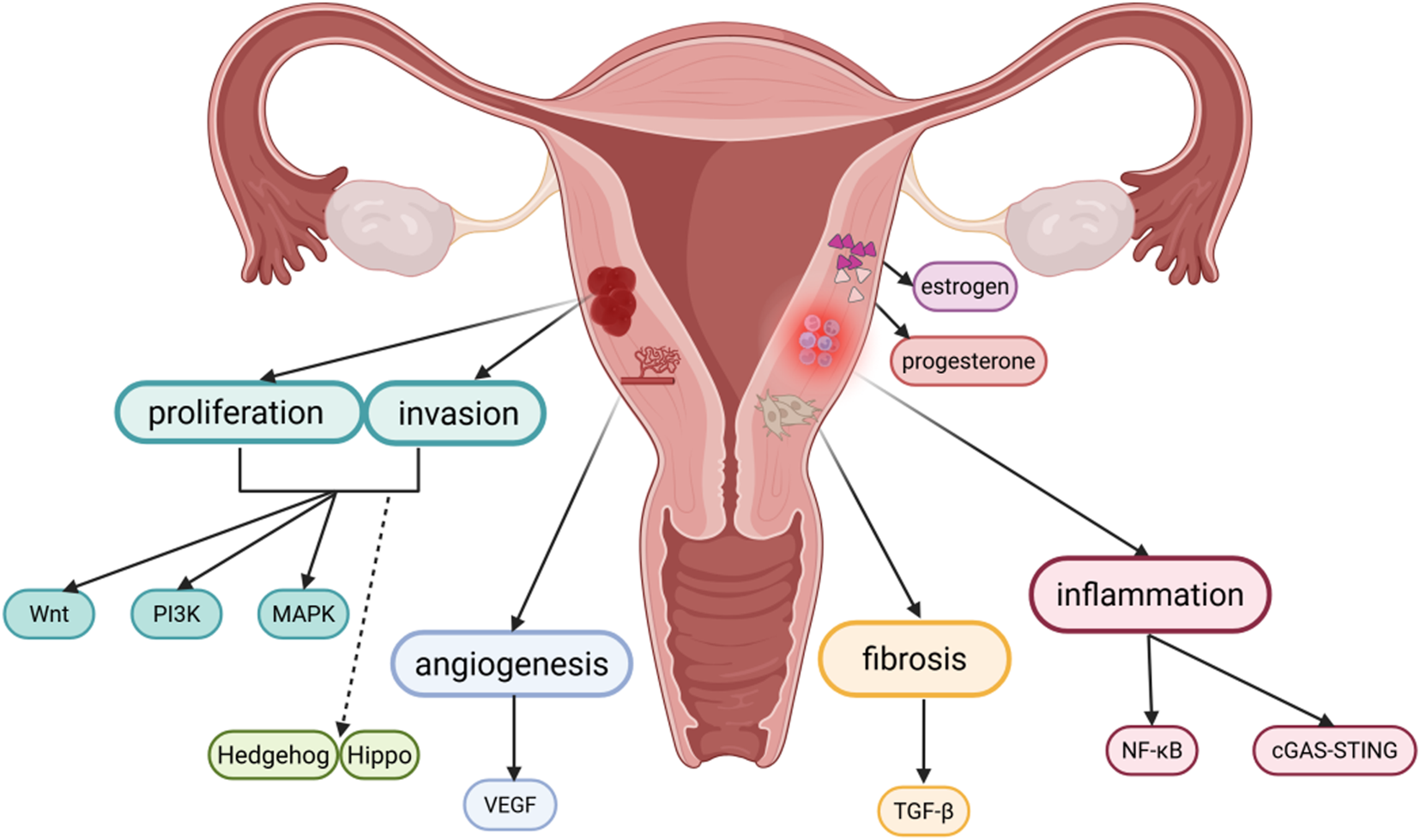 This diagram of adenomyosis illustrates its biological processes, showing that proliferation and invasion are linked to the Wnt, PI3K, MAPK, Hedgehog, and Hippo pathways, that angiogenesis is connected to the VEGF pathway, that fibrosis relates to the TGF-β pathway, and that inflammation involves the NF-κB and cGAS-STING pathways, with estrogen and progesterone also participating in the development of adenomyosis.