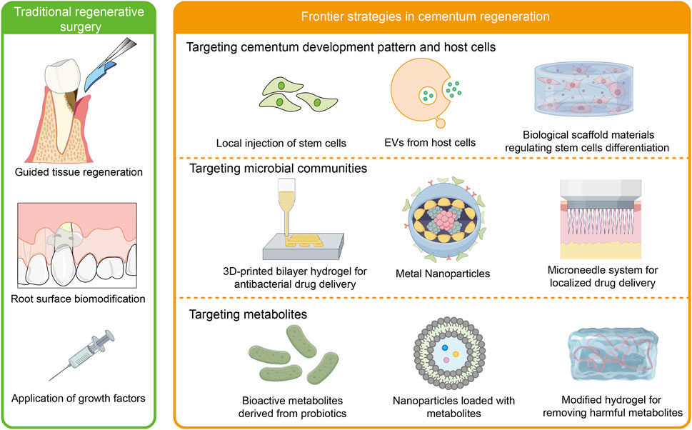 Comparison of traditional regenerative surgery and frontier cementum regeneration strategies. Traditional methods include guided tissue regeneration, root surface biomodification, and growth factor application. Frontier strategies target cementum development, microbial communities, and metabolites, with techniques like stem cell injections, biological scaffolds, 3D-printed hydrogels, metal nanoparticles, bioactive metabolites, and microneedle systems.