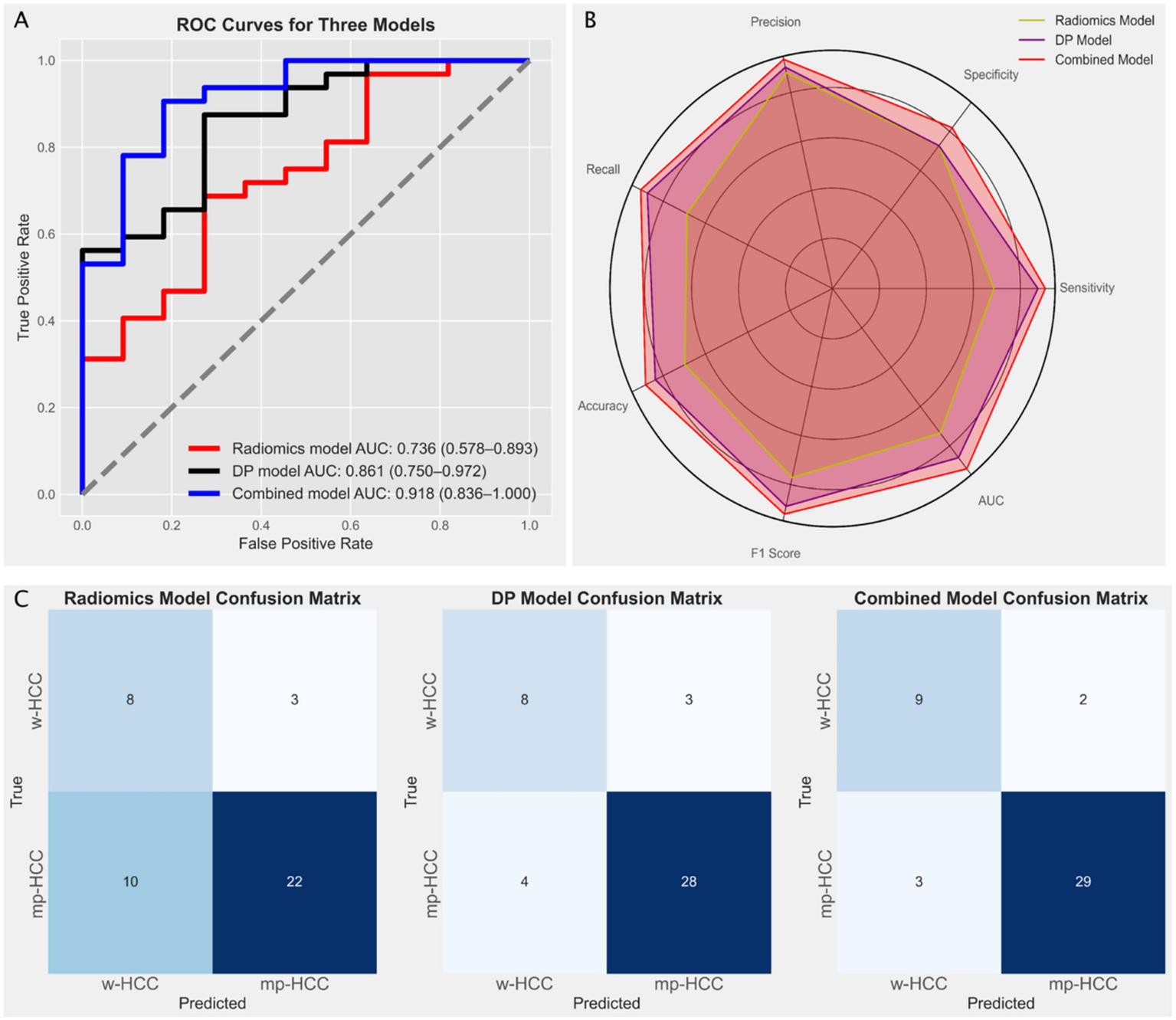 Panel A shows ROC curves for three models: Radiomics (red, AUC 0.736), DP model (black, AUC 0.861), and Combined (blue, AUC 0.918). Panel B is a radar chart comparing Precision, Recall, Accuracy, Specificity, Sensitivity, and AUC among models, with the combined model showing superior measurements. Panel C displays confusion matrices: the Radiomics model misclassifies 10 mp-HCC and 3 w-HCC, the DP model misclassifies 4 mp-HCC and 3 w-HCC, and the Combined model shows the best performance with only 3 mp-HCC and 2 w-HCC misclassifications.