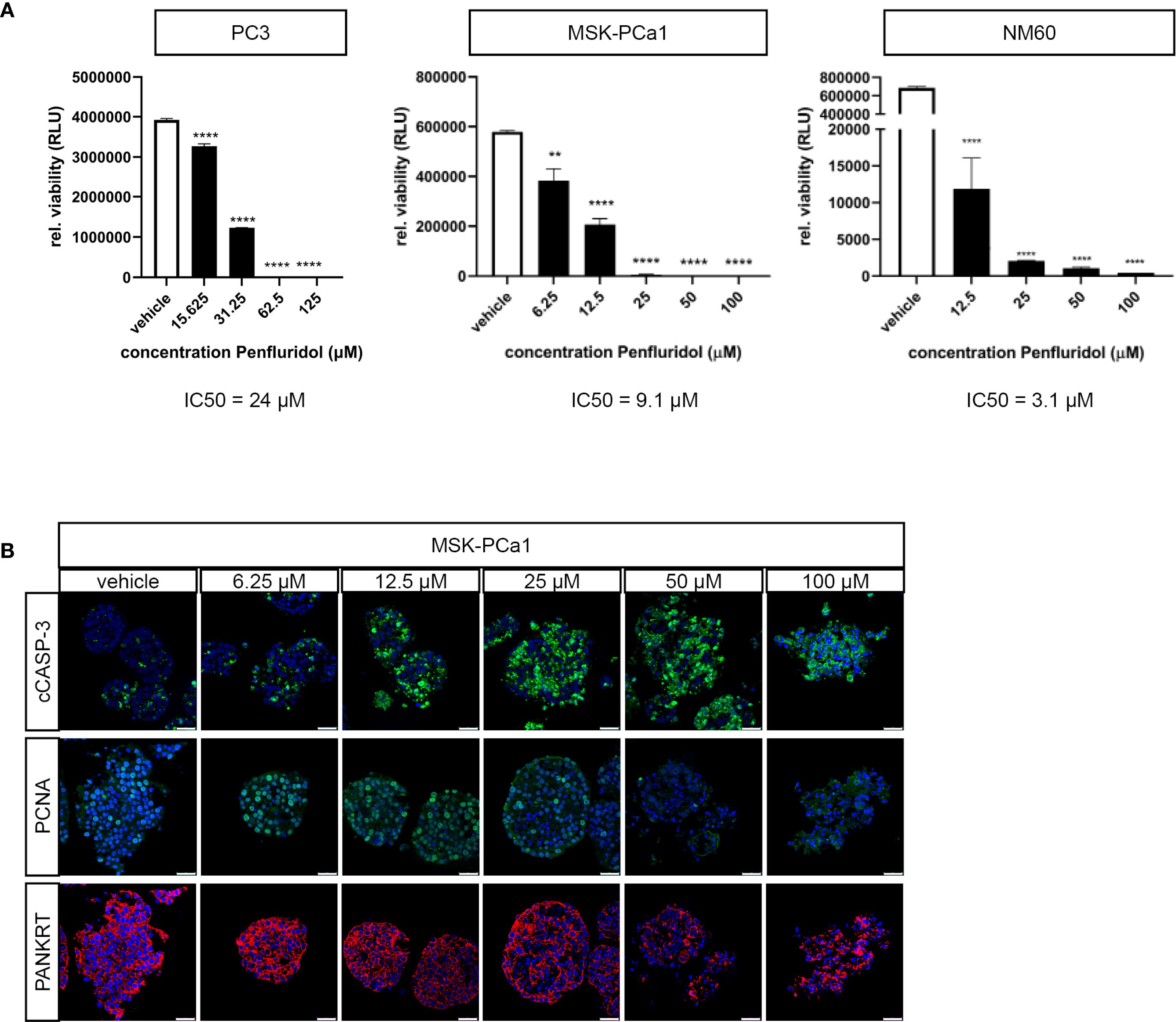 Panel A shows bar graphs of relative cell viability in PC3, MSK-PCa1, and NM60 cell lines treated with various concentrations of Penfluridol. IC50 values are 24 micromolar for PC3, 9.1 micromolar for MSK-PCa1, and 3.1 micromolar for NM60. Panel B presents fluorescence microscopy images of MSK-PCa1 cells treated with vehicle and Penfluridol at concentrations ranging from 6.25 to 100 micromolar, stained for cCASP-3, PCNA, and PANKRT. Different colors indicate protein expression levels.