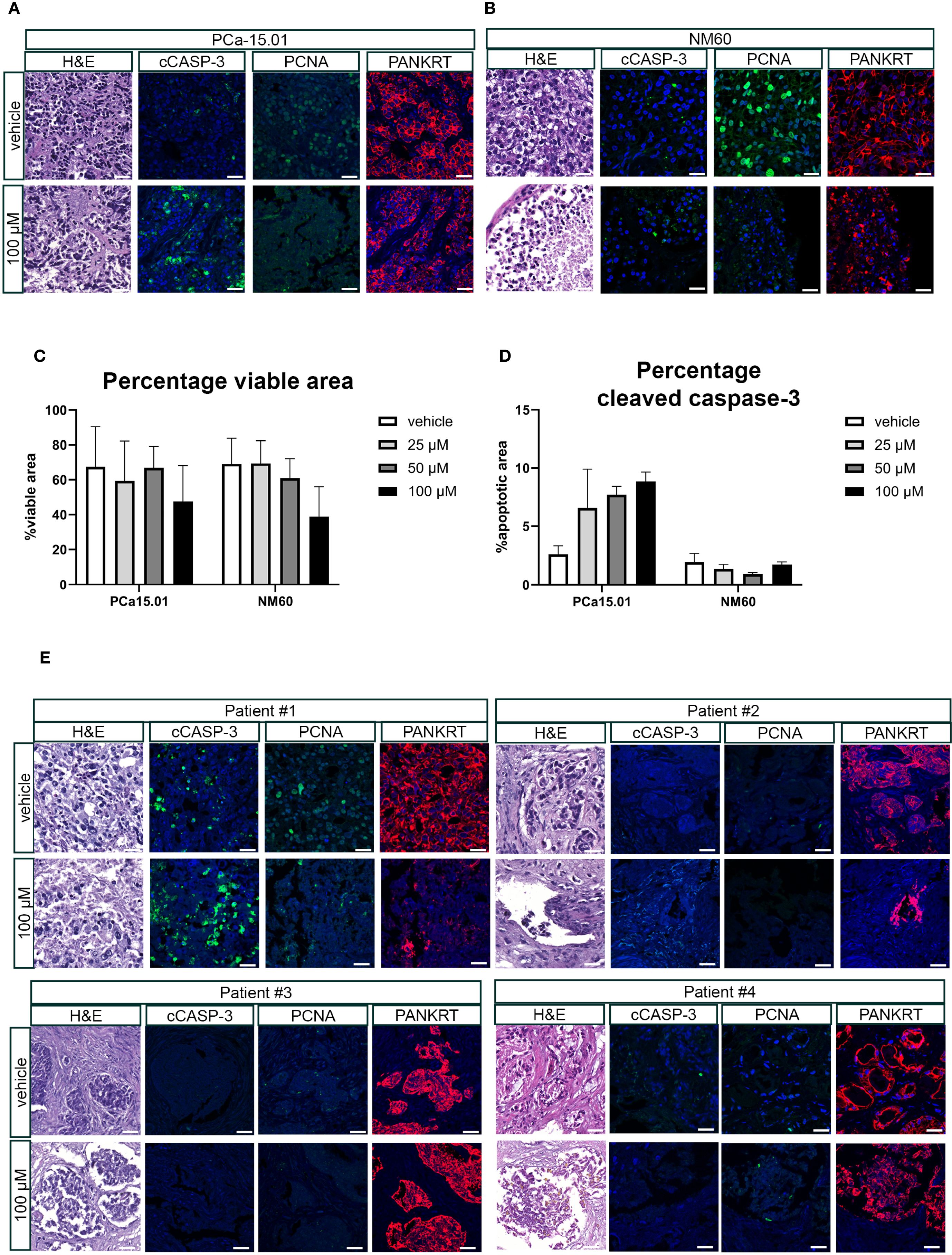Panel images showing tissue samples from different conditions. Panels A and B display stained samples (H&E, cCASP-3, PCNA, PANKRT) for PCa-15.01 and NM60 under vehicle and 100 µM treatment. Panel C and D are bar graphs showing percentage of viable and apoptotic areas for PCa15.01 and NM60 under different treatments. Panel E shows stained tissue samples for four patients, comparing vehicle and 100 µM treated samples with the same staining methods.