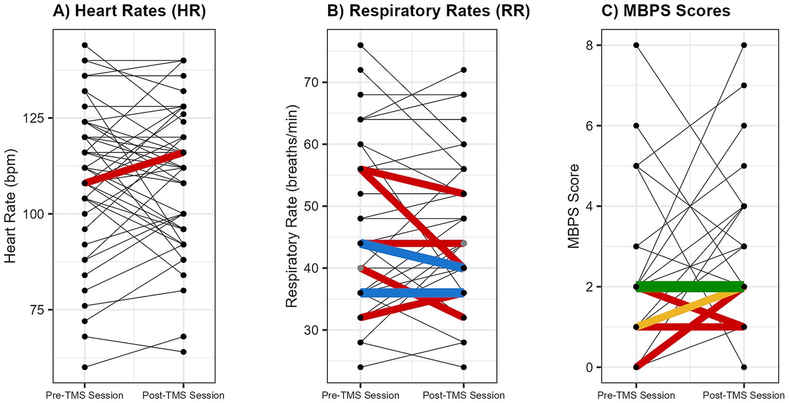 A figure with three panels showing individual changes in heart rate (A), respiratory rate (B), and behavioral pain scores (C) from pre- to post-spTMS session. In each graph, a single line shows the change for one session. The color of the line indicates how often that specific change occurred. For all three metrics, the most frequent changes (shown as green and yellow lines) cluster along the diagonal, indicating that little to no change was the most common outcome.