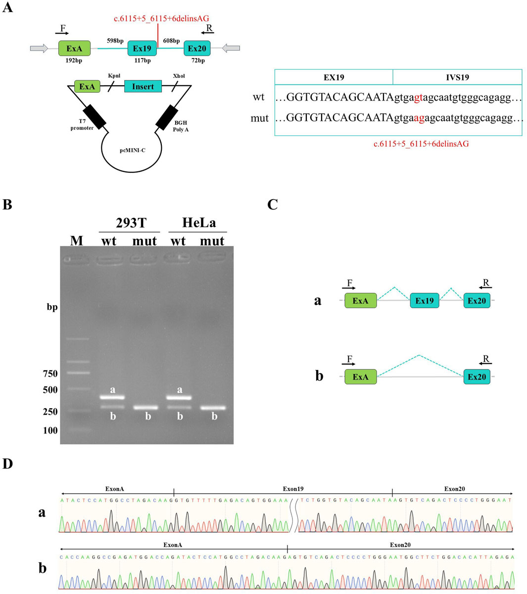Diagram illustrating a genetic experiment. Panel A shows a DNA construct with exons and an insertion mutation labeled c.6115+5_6115+6delinsAG. Panel B displays a gel electrophoresis image with bands labeled for wild type and mutant in two cell lines, 293T and HeLa. Panel C diagrams approaches to the exon arrangement in normal and mutant DNA. Panel D provides sequencing chromatograms for the wild type and mutant, highlighting Exon A, Exon 19, and Exon 20 regions.