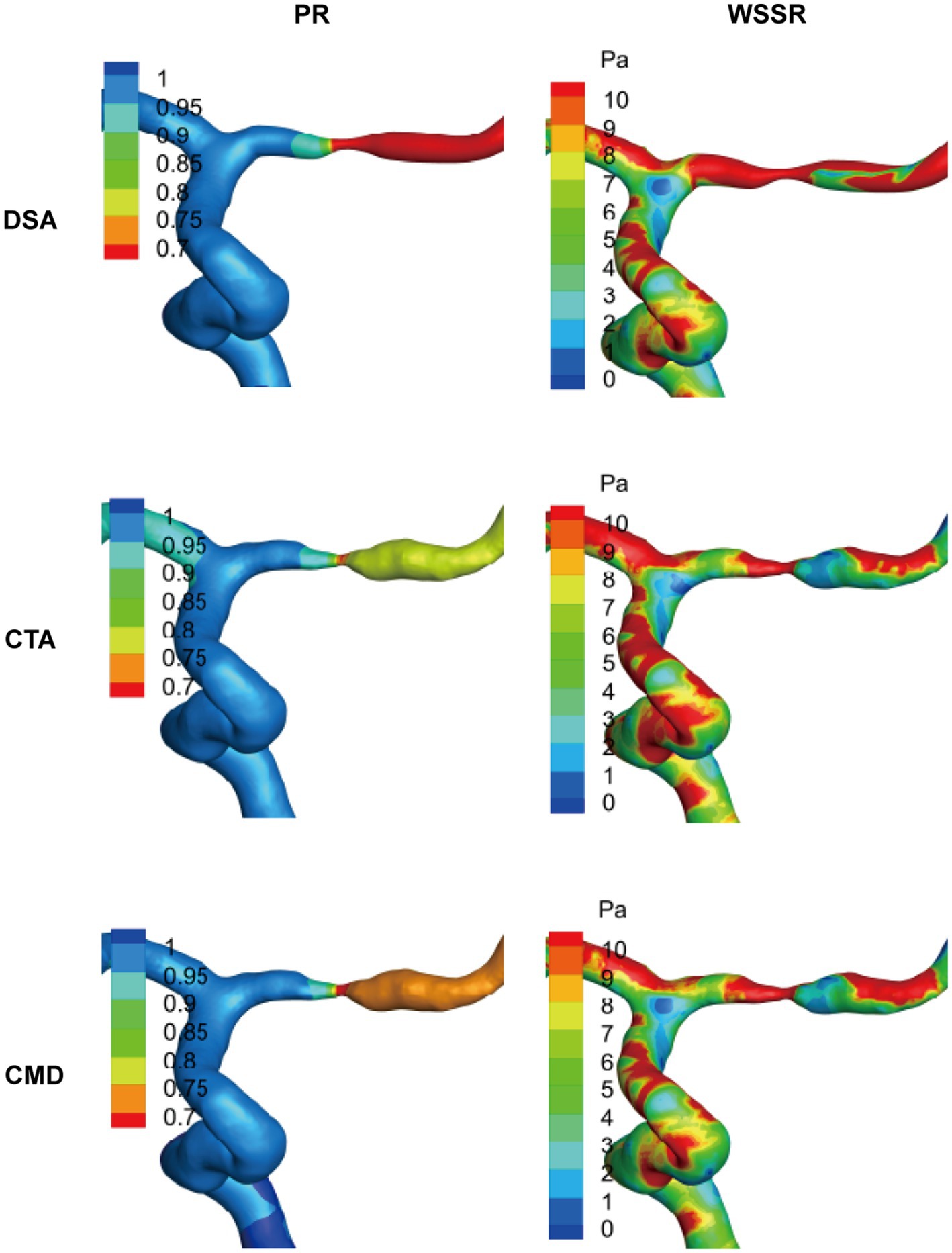 Three pairs of 3D vascular models show simulations of pressure ratio (PR) and wall shear stress ratio (WSSR) in different imaging techniques: DSA, CTA, and CMD. Each pair includes a color scale corresponding to values on the side, illustrating variations in pressure and stress across the vascular structures.