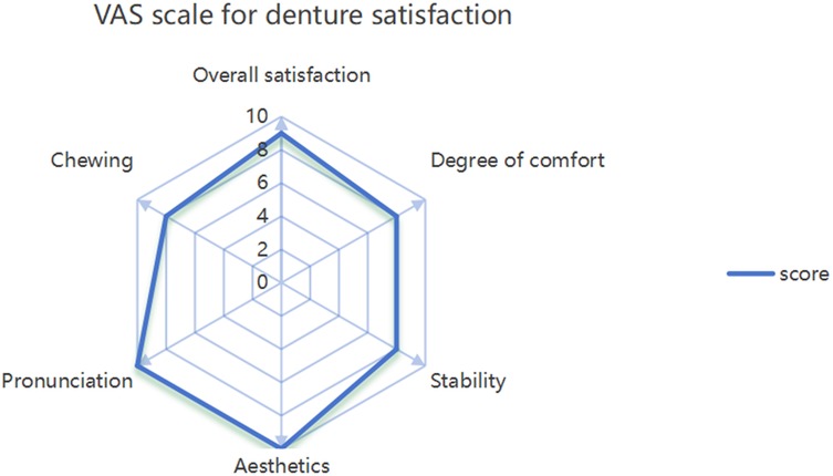 Radar chart showing the VAS scale for denture satisfaction with six parameters: chewing, pronunciation, aesthetics, stability, degree of comfort, and overall satisfaction. Scores range from zero to ten, with higher values indicating greater satisfaction. The plotted blue line shows consistently high satisfaction across all categories, particularly for pronunciation and aesthetics.