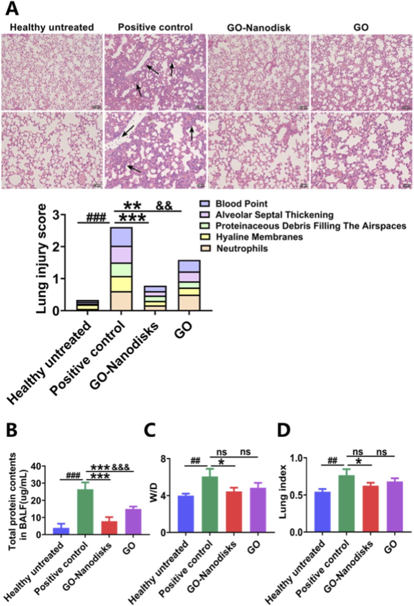 Histological images and graphs display lung injury in different conditions: healthy untreated, positive control, GO-Nanodisks, and GO. The upper panel shows tissue samples, with arrows indicating damage. Lower panel graphs include lung injury scores, protein content in BALF, W/D ratio, and lung index, comparing effects across treatments. The bar colors represent specific pathologies like blood points and proteinaceous debris. Statistical significance is marked by symbols.