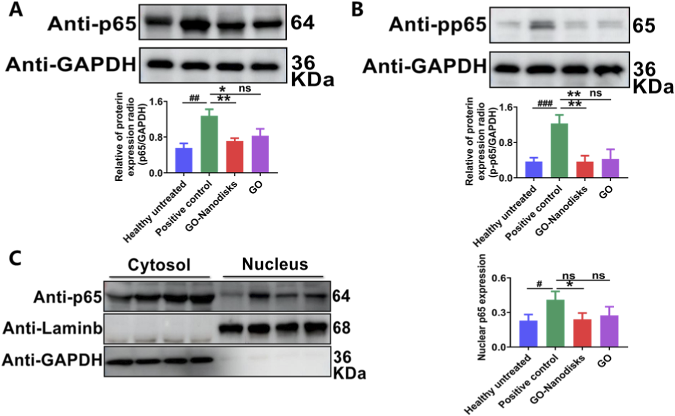 Figure A shows Western blot results for Anti-p65 and Anti-GAPDH, with a bar graph indicating protein expression ratios across four conditions: Healthy untreated, Positive control, GO-Nanodisks, and GO. Figure B displays Western blot results for Anti-pp65 and Anti-GAPDH, with a corresponding graph for protein expression ratios in the same conditions. Figure C presents Western blots comparing cytosolic and nuclear fractions using Anti-p65, Anti-Laminb, and Anti-GAPDH across the conditions, with a bar graph showing nuclear p65 expression. Statistical significance is noted with symbols in the graphs.