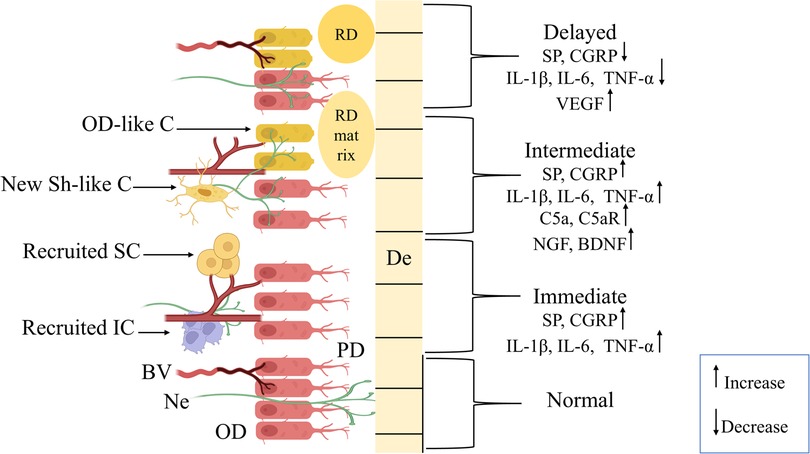Illustration showing nervous system interactions with labeled components: OD-like C (oligodendrocyte-like cells), New Sh-like C (Schwann-like cells), Recruited SC (Schwann cells), Recruited IC (inflammatory cells), BV (blood vessel), Ne (nerve), and OD (oligodendrocytes). Right side outlines response timing: Delayed, Intermediate, Immediate, Normal, with arrows indicating increase or decrease in markers like SP, CGRP, IL-1β, IL-6, TNF-α, VEGF, C5a, C5aR, NGF, and BDNF.