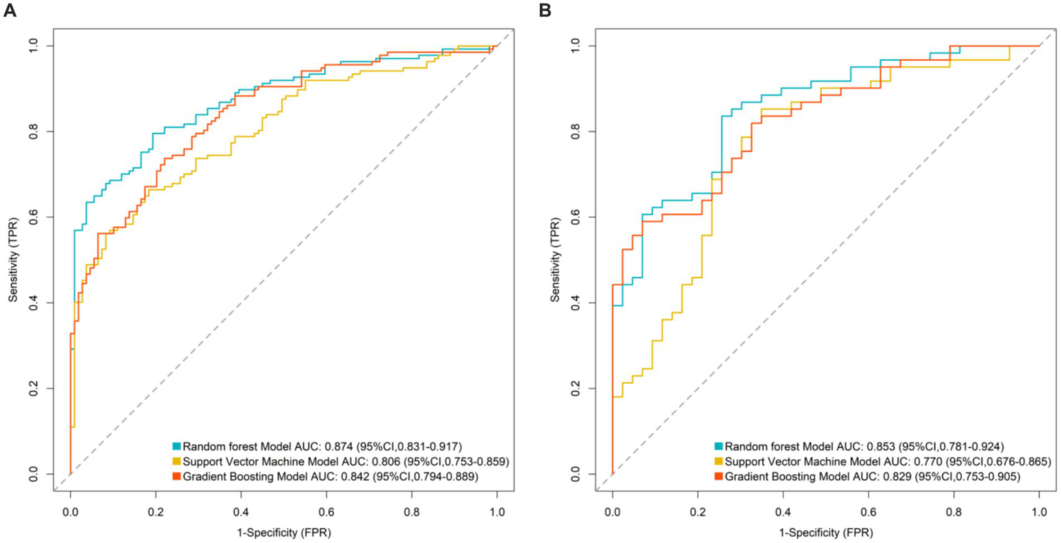 Two ROC curve charts labeled A and B compare three models: Random Forest, Support Vector Machine (SVM), and Gradient Boosting. Chart A shows Random Forest with the highest AUC of 0.874, followed by Gradient Boosting at 0.842, and SVM at 0.806. Chart B indicates Random Forest with an AUC of 0.853, Gradient Boosting at 0.829, and SVM at 0.770. Sensitivity versus 1-Specificity is plotted for each model with color-coded lines.