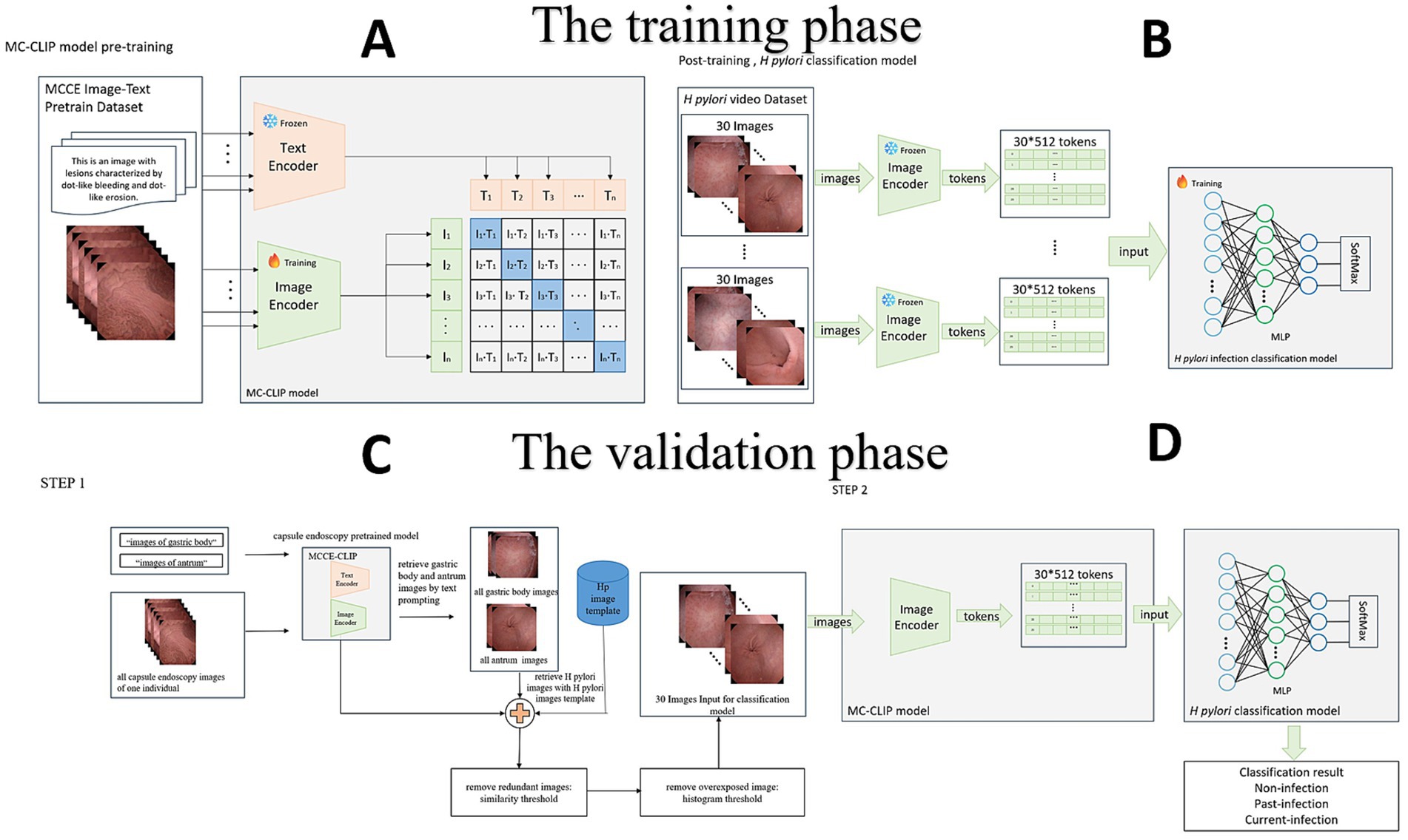 Diagram illustrating the MC-CLIP model phases for H. pylori classification. The training phase (A and B) involves pre-training using image-text datasets and encoding them for classification through a neural network. The validation phase (C and D) uses the pre-trained model to classify gastric images, refining inputs by removing redundant or overexposed images before final classification into infection status.