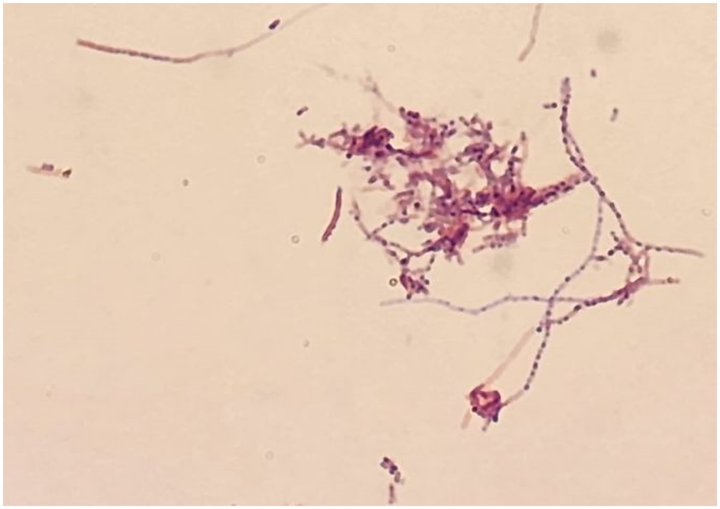 Microbiological image showing Gram-positive branching filaments under a microscope, likely indicating a species of Actinomyces. The filaments are stained purple and are set against a light background.