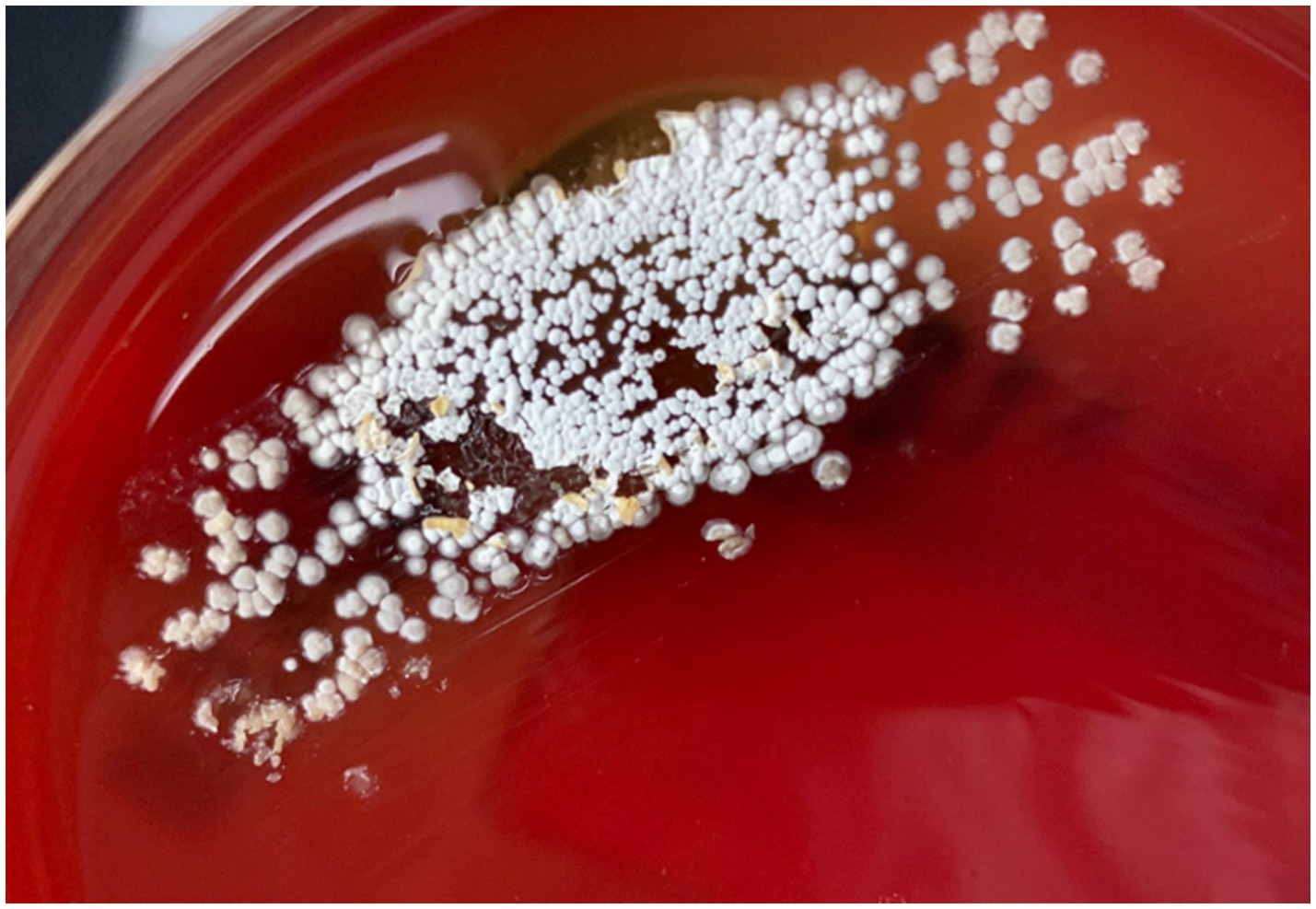 Colonies of bacteria are growing on a reddish agar plate, appearing as dense clusters of small white circular formations. The background is smooth and contrasts with the textured surface of the colonies.