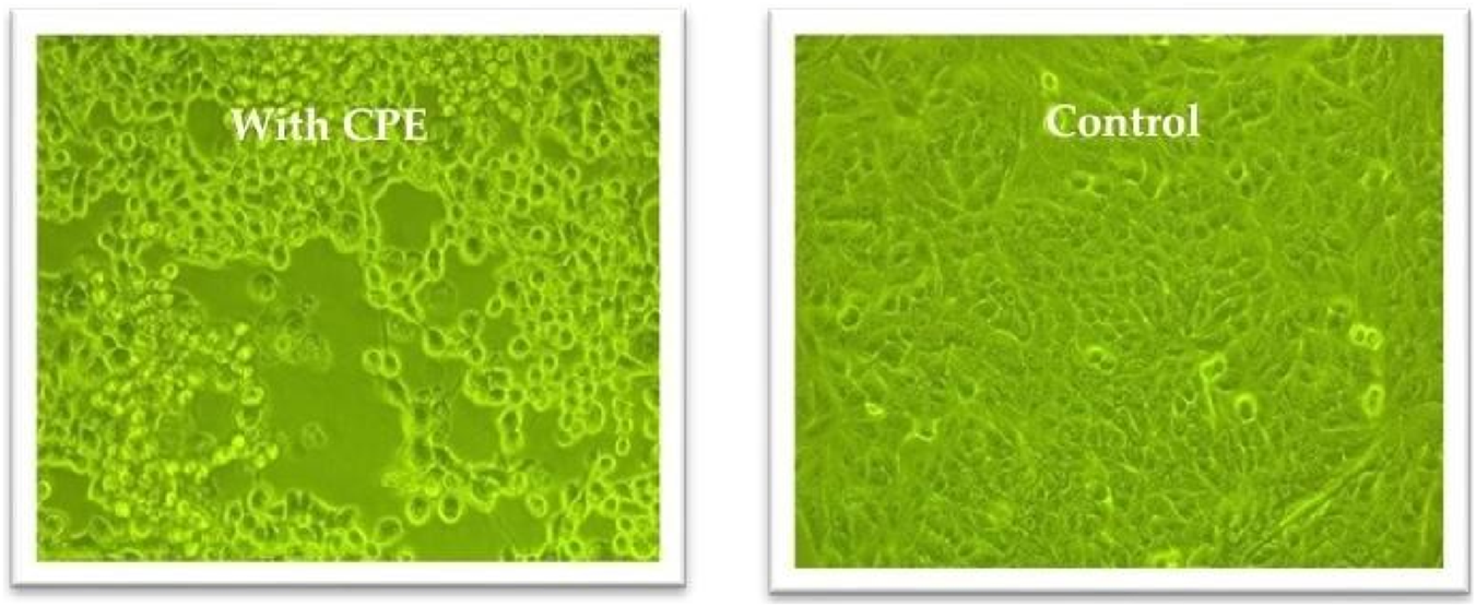 Two images showing cells under a microscope. The left image labeled "With CPE" shows disrupted cellular structure, indicating cytopathic effects. The right image labeled "Control" displays a normal, intact cell structure without disruption.