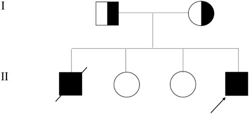 A pedigree chart with two generations labeled as I and II. The first generation shows a square and a circle, each half-shaded. The second generation has four symbols: a shaded square with a diagonal line, two unshaded circles, and a fully shaded square with an arrow indicating significance.