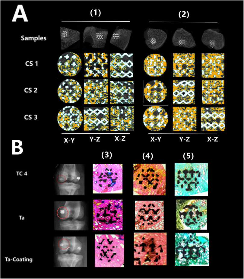 Composite image depicting two sections labeled A and B. Section A shows black and white sample images with three cross-sectional views (X-Y, Y-Z, X-Z) of three samples labeled CS 1 to CS 3, arranged in two columns (1) and (2). Section B presents three rows labeled TC 4, Ta, and Ta-Coating, each showing an X-ray image followed by three colored microscopy images. Each row corresponds to a different material or treatment, with variations observed across the sections.