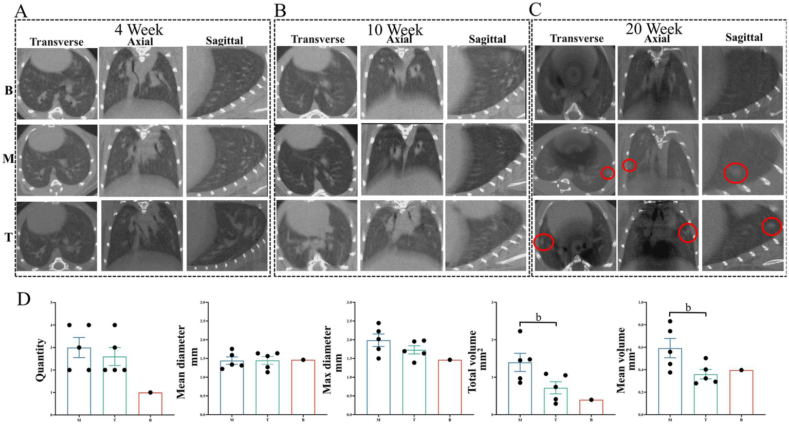 CT scans showing transverse, axial, and sagittal views of lungs at 4, 10, and 20 weeks. Red circles highlight abnormalities at 20 weeks. Accompanying graphs display measurements of quantity, mean diameter, maximum diameter, total volume, and mean volume with statistical comparisons indicated by bracketed "b" notations.