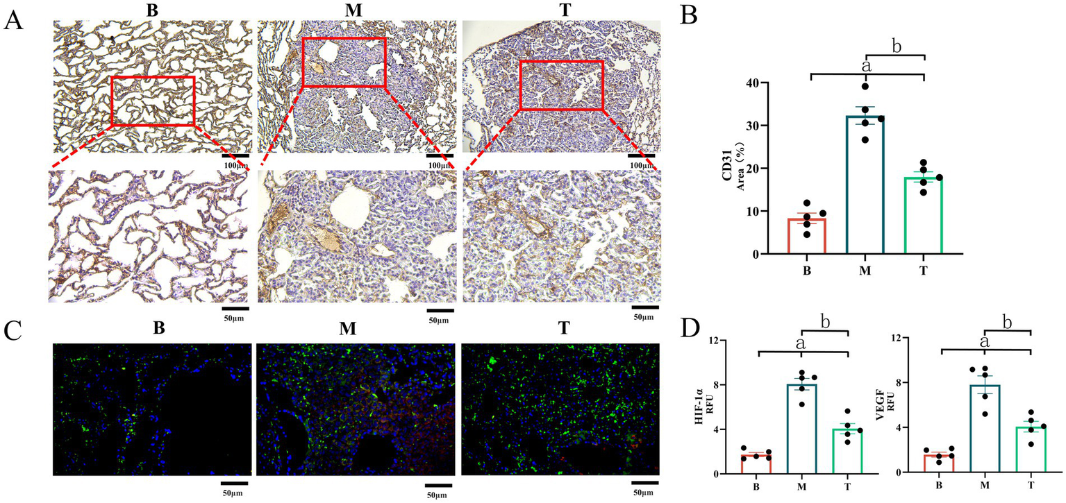 Histological and fluorescent images of tissues labeled B, M, and T show cellular structures with varying densities and staining patterns. Graphs display quantitative analysis of CD31 area, HIF-1 alpha, and VEGF levels, highlighting significant differences between groups.