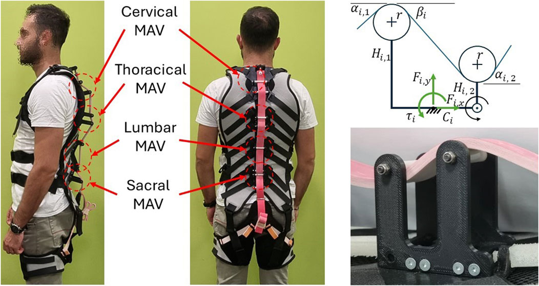 Side and back views of a person wearing a multi-articular vest (MAV) suit illustrating cervical, thoracic, lumbar, and sacral sections with red arrows pointing to each part. A diagram shows mechanical components labeled with symbols like \( \alpha_{i,1} \), \( \beta_i \), and others. Below, a close-up of a black mechanical component with a pink strap is displayed.