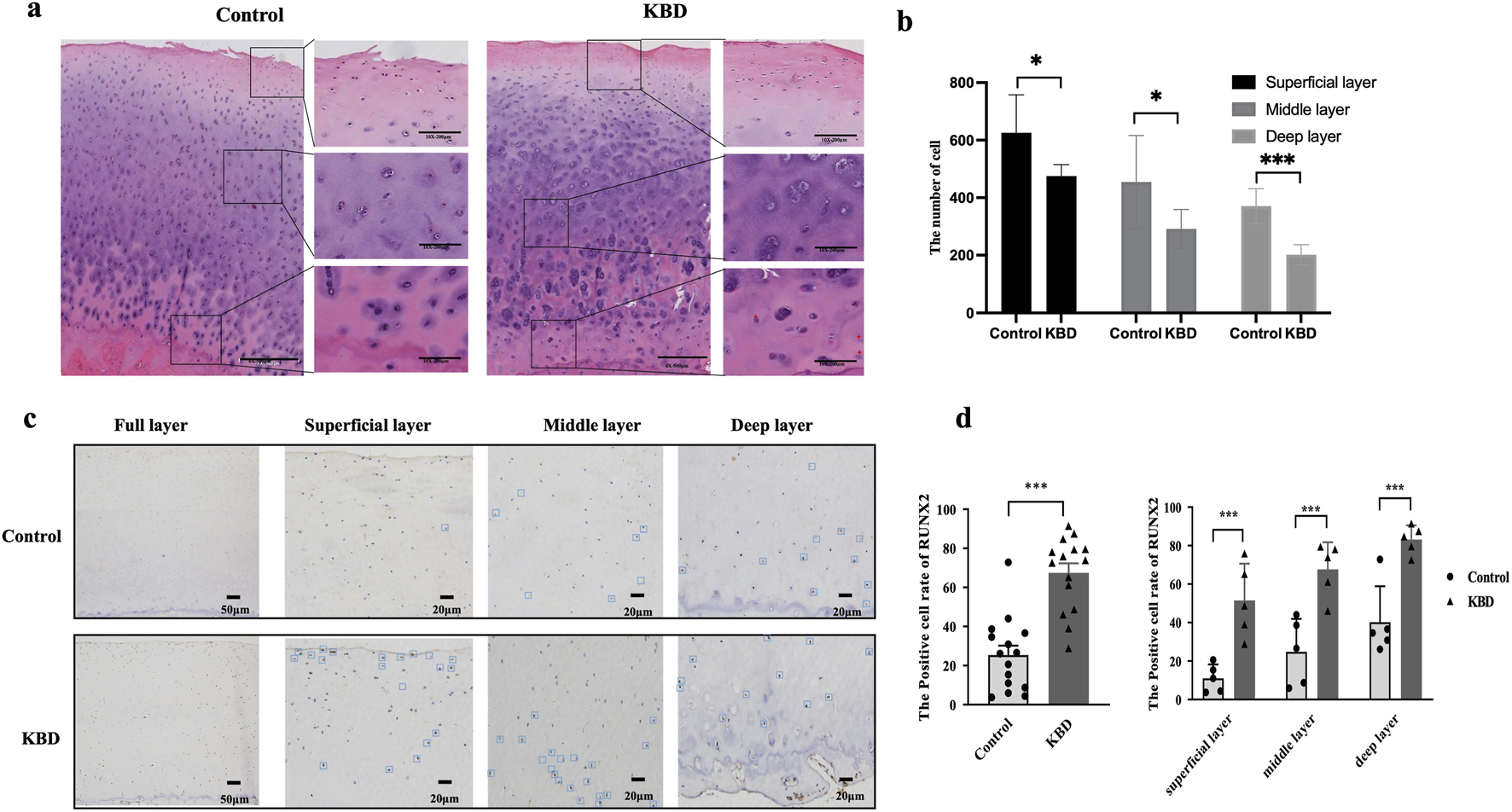 Panels a and c show histological images comparing control and KBD tissue, with magnifications on specific layers. Panel b is a bar chart displaying the number of cells across superficial, middle, and deep layers for control and KBD, indicating significant differences marked by asterisks. Panel d shows bar charts comparing the positive cell rate of RUNX2 across different layers and conditions, also highlighting significant differences with asterisks.