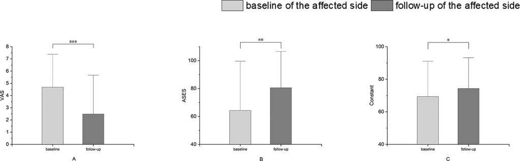 Three bar charts compare baseline and follow-up data for the affected side. Chart A shows a significant decrease in VAS scores with three asterisks. Chart B indicates an increase in ASES scores with two asterisks. Chart C displays a rise in Constant scores with one asterisk. Baseline is light grey, and follow-up is dark grey.
